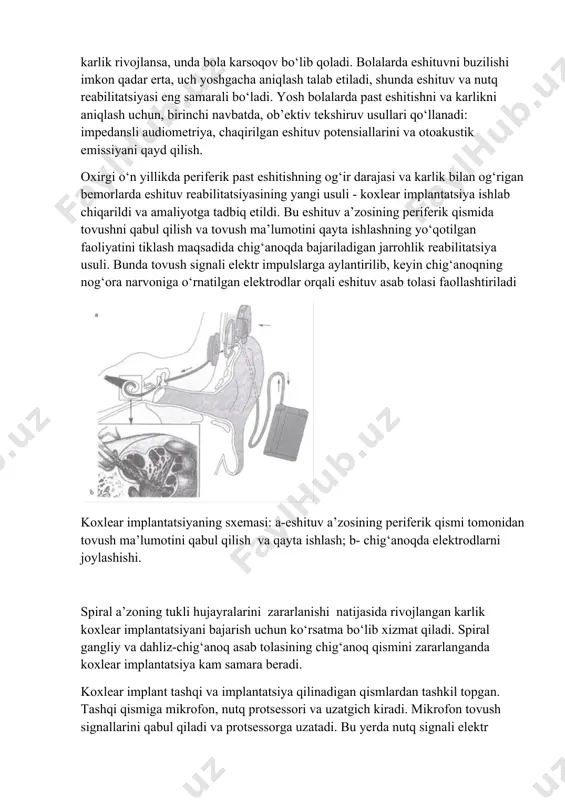 ilan cheklanadi, chunki tovushni ushbu chegaradan ortiq kuchaytirilishi bemorda og‘riqni paydo qiladi va nutqni anglash qobiliyatini yomonlashtiradi. tebranuvchi tovush ko‘prigi (vibrant soundbridge) usuli an’anaviy eshituv asboblariga musoboqadosh (alternativ) bo‘lib xizmat qiladi, u sensonevral past eshitishning o‘rtacha va og‘ir darajalarida (89 db gacha) eshituvni yaxshilash imkonini beradi. ijtimoiy karlik – bu tonal eshituvni 89 db va undan ortiq yo‘qotilishi bo‘lib, bunda inson faqat quloq suprasi yonida qichqiriqni eshitadi va atrofdagilar bilan muloqot qilolmaydi. agar eshituv asbobi samara bermay, muloqot qiyinlashsa yoki iloji bo‘lmasa, unda bemorni lablariga qarab o‘qish va atrofdagilar bilan mimika va qo‘l harakatlari bilan muloqot qilishga o‘rgatiladi. nutq buzilishlari bilan chambarchas bo‘g‘liqligi past eshitishni o‘ziga xos xususiyati hisoblanadi, chunki eshituv va nutq insonlar orasidagi nutqiy aloqaning yagona jarayoni bo‘lib xizmat qiladi. agar bolada tug‘ma karlik aniqlansa yoki hali gapirishni o‘rganmagan davrida karlik rivojlansa, unda bola karsoqov bo‘lib qoladi. bolalarda eshituvni buzilishi imkon qadar erta, uch yoshgacha aniqlash talab etiladi, …