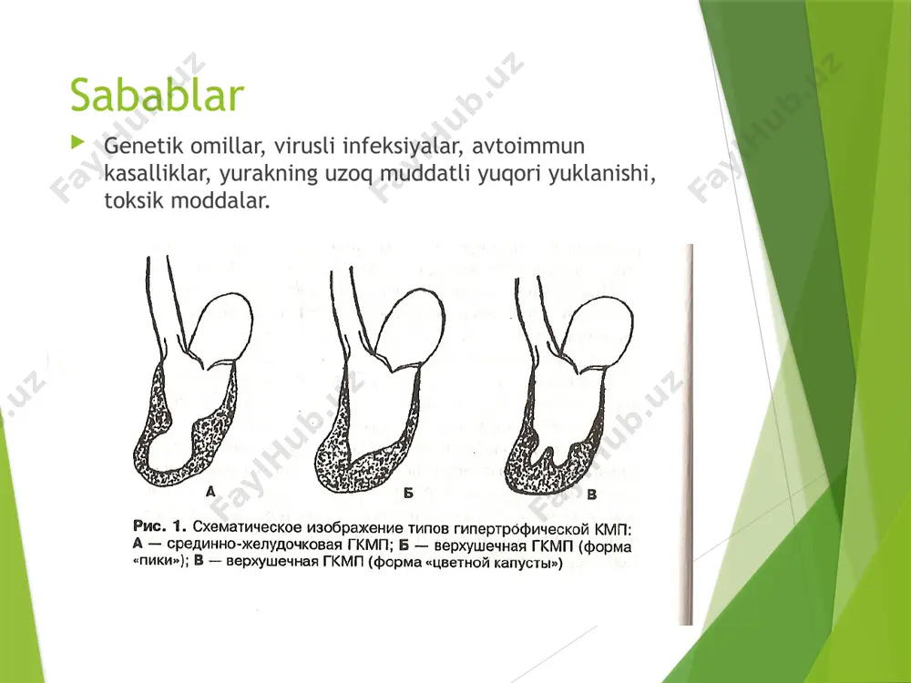 kardiomiopatiya turlari, belgilari, tashxislash va davolash usullari - Page 4