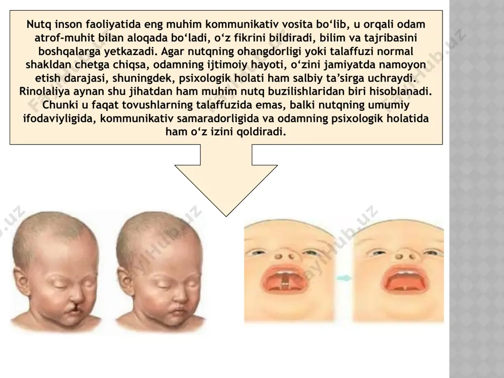 v ta'limga moslashuvi” (2025). maqolada rinolaliyasi bo‘lgan bolalarning ta’lim muhitiga moslashuvi, nutq buzilishining anatomik/fiziologik jihatlari va logopedik korreksion ishlash usullari muhokama qilingan. 4.xurshidjon bediendyorov — “rinolalik va dizartrik bolalar bilan logoritmik mashg'ulotlarni o'tkazish” (2023). bu maqola rinolaliyasi bo‘lgan bolalarda artikulyatsion va fonatsion (nutq hosil qilish) jarayonidagi buzilishlar, korreksion mashqlar, nafas va ovoz ustida ishlash metodlari haqida. 5.dilshoda ikromova & d. d. oribboeva — “logopedning rinolaliyada olib boradigan korreksion ishlari” (2022). ushbu maqolada yumshoq tanglay bilan bog‘liq rinolaliya turidagi nutq nuqsonida logopedik korreksion ishlar, talaffuzdagi kamchiliklarni kamaytirish, nafas mashqlari va nutq apparatini mustahkamlash ishlari tahlil qilingan. image1.jpeg image2.png image3.png image4.png image5.png image6.png image7.png /docprops/thumbnail.jpeg