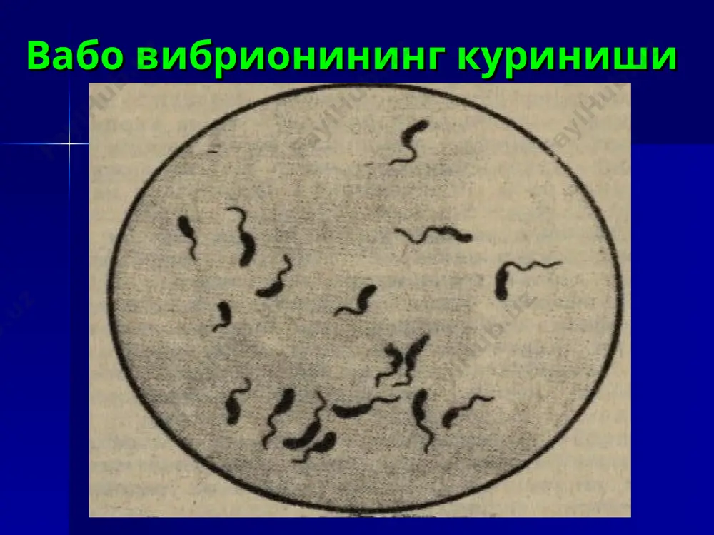 ва тугри булади. в.н.никифоров куйидаги формулани тавсия килади: v=15,5 х 104 х м х (х-1,025) v – бирламчи регидратация учун лозим булган эритма микдори (мл); 15,5 х 104 – коэффицент; м – бемор танасининг юзаси (м2) крауфорд номограммаси ёрдамида аникланади; х – бемор кони зардобининг нисбий зичлиги; 1,025 – соглом инсонларнинг кон зардобининг нисбий зичлигини меъёрий курсаткичи. гипогликемияни коррекция килишда биз формулада беморнинг тана огирлигидан эмас, балки танасининг юзасини курсаткичидан фойдалансак гипо- ва гипергликемиянинг олдини олиш мумкин. масалан: 56 х м х (5-х)=v(мл) 56 – коэффицент; м – бемор танасининг юзаси крауфорд номограммаси ёрдамида аникланади (м2); 5 – зардобдаги калийнинг меъёрий микдори (мэкв/л); х – беморни кон зардобидаги калийнинг микдори (мэкв/л); v – перфузион системага куйиш лозим булган 1% калий хлорнинг микдори (мл). агар калий микдори жуда юкори булса куйидаги дорилардан бирини томирдан куйиш тавсия этилади: 1. 25% глюкоза эритмасидан 250 мл + кристаллик цинк инсулин 60 бирликда томирга томчида …