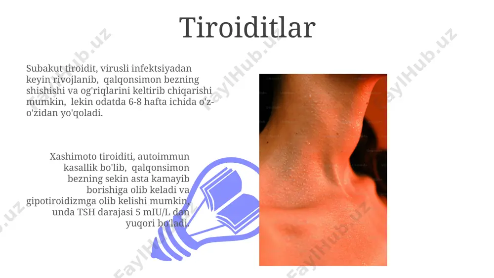 iruvdan o'tish va profilaktik tekshiruvlardan muntazam o'tish 5-10 yilda bir marta kasallikni erta aniqlash va davolash imkonini beradi. sog'lom turmush tarzini yuritgan holda, muntazam jismoniy mashqlar bilan shug'ullanish va stress darajasini nazorat qilish qalqonsimon bezning normal ishlashini qo'llab-quvvatlaydi, shuningdek, autoimmun kasalliklar xavfini kamaytiradi. qalqonsimon bezning radiatsion terapiyasi radiatsion terapiya dozasini aniqlashda bemorning yoshi, o'smaning turi va hajmi, shuningdek, umumiy sog'liq holati kabi omillar hisobga olinadi, bu esa individual yondashuvni ta'minlaydi. qalqonsimon bezning radiatsion terapiyasi 131i yod izotopidan foydalanadi, bu hujayralar tomonidan yutilgandan so'ng, bezning o'smalarini yo'q qilishga yordam beradi va taxminan 70-80% samaradorlikka ega. qalqonsimon bezning avtoximmun kasalliklari 01 02 subakut tiroidit, virusli infektsiyadan keyin rivojlanishi mumkin bo‘lgan, qalqonsimon bezning yallig‘lanishiga olib keladigan va ba’zan avtoimmun reaktsiyalar bilan bog‘liq bo‘lishi mumkin bo‘lgan bir holatdir. sales 1st qtr 2nd qtr 100 0 sales 1st qtr 2nd qtr 100 0 gipotiroidizm gipotiroidizmda tsh darajasi 5 miu/l dan yuqori boʻlishi mumkin, bu qalqonsimon …