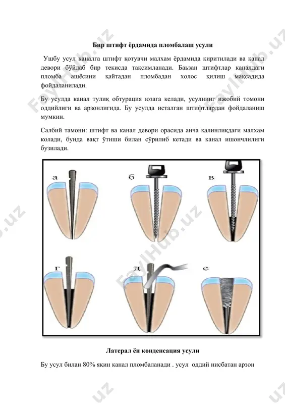 илдиз каналларини пломбалаш усуллари - Page 4