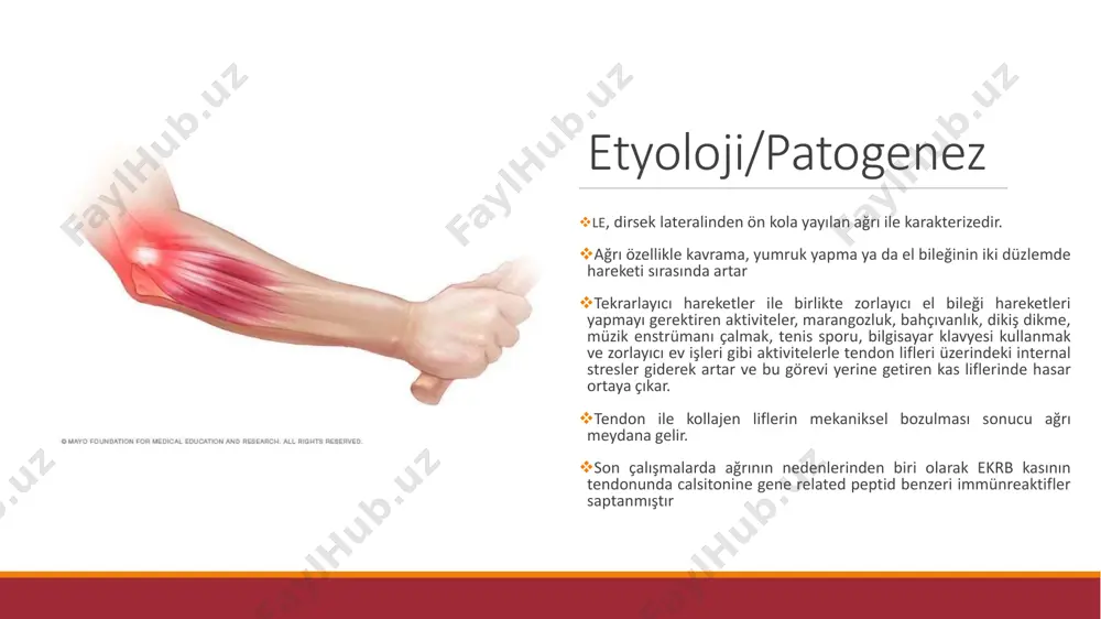 n hızlandırılması ve hastanın günlük yaşam aktivitelerindeki fonksiyonelliği optimum sürede geri kazanabilmesinin sağlanmasıdır rehabi̇li̇tasyon enjeksi̇yon egzersi̇z akti̇vi̇te modi̇fi̇kasyonu ortez-spli̇nt-bantlama efa manuel tedavi̇ tamamlayici tip enjeksi̇yon ❖kortikosteroid enjeksiyonu: başlangıç tedavisi için gold standart ancak kısa dönemde etkili uzun dönemde tendonun yapısını zayıflatıyor. ❖prp : uzun dönemde steroidten daha etkili ❖botillinium toksin: kanıtlar yetersiz egzersi̇z eksentrik pronasyon yetersizliği yaygın ekstansör kas orijininde artmış yüklenme radius başının medial veya i̇nferiora yer değiştirmesi sonuç supinatör ve ekrb kasının eksentrik restorasyonuna i̇htiyaç vardır üst ekstremite kaslarının i̇lerleyici dirençli egzersiz programı ve özellikle el bileği ve elin ekstansör kaslarının eksentrik kasılması egzersi̇z ❖eksentrik eğitim; tenositlerdeki mekanoreseptörleri kollajen yapımı için uyararak tendonu kuvvetlendirir. ❖eksentrik eğitim esnasında hasarlı bölgeye kan akımı kesilir ve neovaskülarizasyonla yeni damar oluşumları uyarılır, kan akışı artar ve uzun dönemde iyileşme beklenir. ❖kontraksiyonlar esnasında, kolun destekli olması ve 3 set halinde, 10’ar tekrarlı olması önemlidir. ❖ayrıca, önkol pronasyonda ve dirsek tam ekstansiyonda olmalıdır, bu …