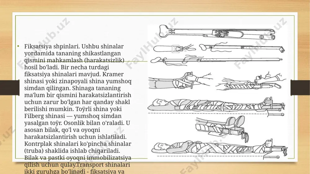 transport immobilizatsiya - Page 4