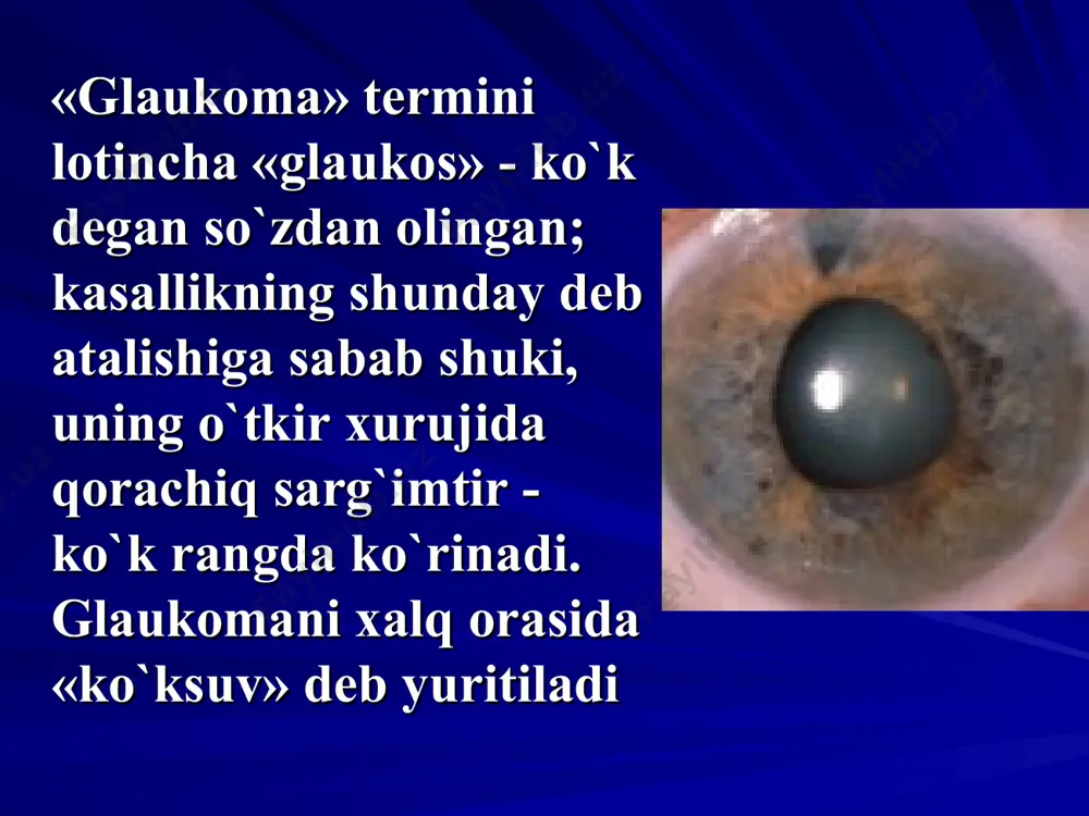tunining 50 mm va bundan yuqori) bo`ladi. glaukomaning asosiy asorati bemorning ko`r bo`lib qolishidir! glaukoma kasalligiga tashhi qo`yish ko`rishning xiralashishi ko`z oldida tuman paydo bo`lishi bosh va ko`zda og`riq paydo bo`lishi yorug`lik manbaiga qaraganda rangdor doiralar ko`rinishi sababsiz ko`zdan yosh oqishi o`qiganda ko`z charchashi va shu sababli ko`zoynakni tez-tez almashtirib turish zaruriyati bemor shikoyatlarini e`tiborga olish glaukoma kasalligiga tashhi qo`yish ko`rish o`tkirligining pasayishi ko`rish maydonida nuqsonlar paydo bo`lganligi palpatsiyada ko`z ichi bosimining oshganligi ko`ruv nervi atrofiyasi va ekskavatsiyasini aniqlash ob’ektiv korikda: glaukoma kasalligiga tashhi qo`yish maklakov tonometri yordamida ko`z ichi bosimi o`lchanadi elastonometrik egri chiziq chiziladi instrumental tekshiruv o`tkazish glaukoma kasalligini davosi ko`z ichi bosimini pasaytiruvchi dori vositalarini qo’llash (pilokarpin, ezerin eritmalari, furamon, fosfakol kabilar ) konservativ davo vena ichiga yoki muskul orasiga 5% tiamin (vitamin v1) eritmasidan har kuni yoki kunora 1 ml dan, natriy xlorid eritmasidan kunora in’ektsiya qilish. bundan tashqari, glaukomaga duchor bo`lgan har bir bemorda yurak-tomir …