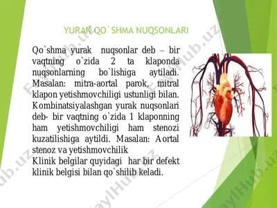 qo`shma yurak nuqsonlari — PDF
