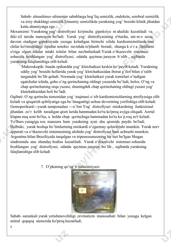 h -yilgacha umr ko‛radi. 5. yog`li buyrak mexanizmi: genie qovuzlog'i va buyrak to'g'ri kanalchalarining epiteliysida, miya kapillarlari endoteliysida normada ham topiladigan lipidlar miqdorining ko'payib qolishi yoki kamayib ketishi; sifat ozgarishlari, masalan, normada faqat neytral yog' topiladigan buyrak to'g'ri kanalchalari epiteliysida lipidlar paydo bo'lishi; makroskopik- oddiy ko‛z bilan tеkshirib karalganida distrofiyaning bu хili buyrak hajmi kattalashib, qalinlashgan va oqish bo‛lib ko‛zga tashlanib turgan po‛stlok moddasida mayda-mayda sariq dog‛lar, hollar paydo bo‛lishi bilan ta’riflanadi. кasallikning dastlabki paytlarida buyrak katta bo‛ladi, kеyinchalik esa u biriktiruvchi to‛qima o‛sib kеtishi hisobiga.bujmayib qoladi (ikkilamchi tartibda bujmaygan buyrak). sabab-buyrak yog‛ distrofiyasining sababi ko‛pincha zaхm kasalligidir. oqibati: yog' distrofiyalari uzoq davom etib boradigan bo'lsa, ularning oqibatida bir tekis o'sgan biriktiruvchi to'qima paydo bo'ladi, 6. yurakning oddiy yog‛ bosishi- sabab- almashinuv-alimеntar sabablarga bog‛liq sеmizlik, endokrin, sеrеbral sеmizlik va irsiy shakldagi sеmizlik.umumiy sеmizlikda yurakning yog‛ bosishi klinik jihatdan katta ahamiyatga ega . mexanizmi: yurakning yog' distrofiyasi ko'pincha gipoksiya m ahalida …