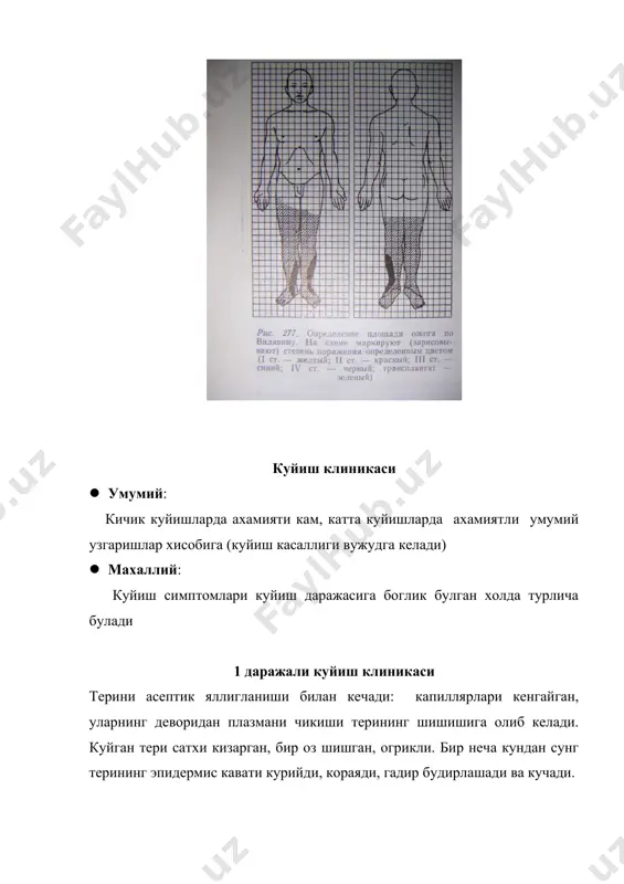 ралари ва улардан кон кетиш кузатилади септик (септикотоксемик) боскич · куйиш касаллигининг 2-3-хафтасида ривожланади. · жигар-буйрак етишмовчилиги, сувсизланиш, ацидоз, гипопротеинемия кучаяди. оксидланиш процесслари бузилади. · бемор конида микроблар пайдо булади реконвалесценция боскичи · куйиш касаллигини яхши кечиши билан реконвалесценция боскичи бошланади. бошланиш муддати куйиш чукурлиги ва майдонига боглик. · беморларнинг ахволи яхшиланади, иштахаси пайдо булади, эпителизация бошланади куйиш касаллигини даволаш · шокни даволаш учун кунига 2-3 соат ичида 1 литргача плазма, кон куйиш лозим. ундан ташкари 3-5 литргача тузли эритмалар, глюкоза, желатинол, реополюгликин куйиш керак адекват огриксизлантириш учун: наркотик ва нонаркотик анальгетиклар, антигистамин дори воситалари юборилади куйиш токсемиясини даволаш · биринчи икки кунда тана огирлигининг хар бир килограммига 3 мл тугри келадиган ва куйган майдон хажмига купайтирилган инфузион даволаш олиб борилади. инфузион терапия тана огирлигининг 10% ошмаслиги керак. масалан, бемор огирлиги 70кг булса, кун давомидаги инфузион суюклик микдори 7 литров ошмаслиги лозим. (r.moore, a.wallace) токсемияни даволаш · махаллий даво- некрэктомия …