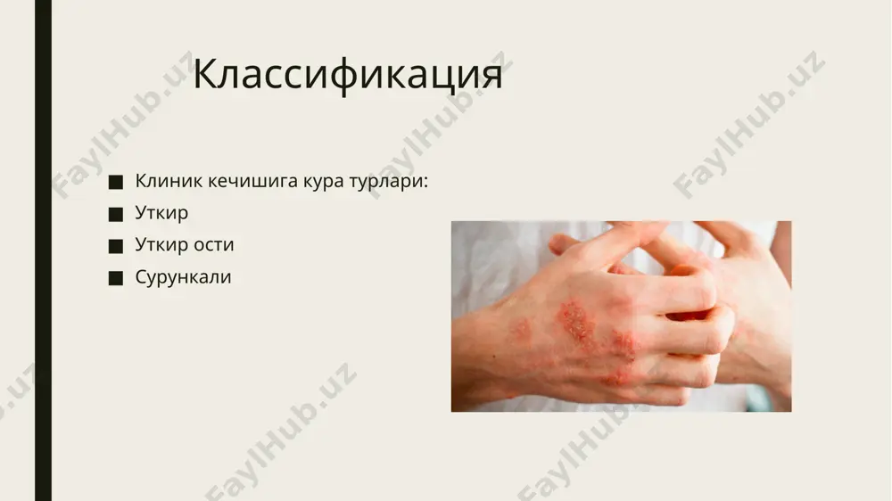 экзема - Page 4