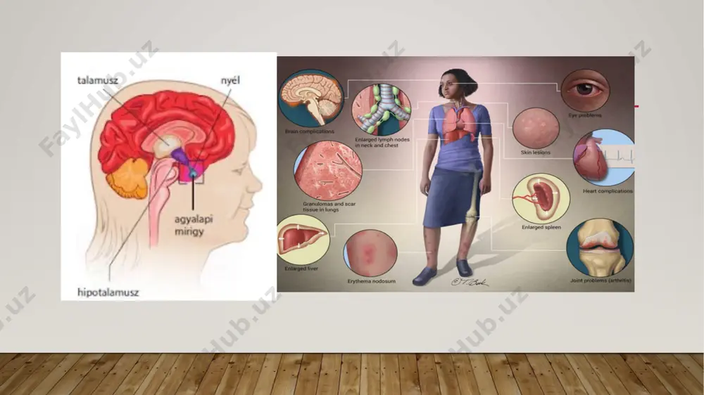 mlari paydo bo'ladi, jismoniy chidamlilik pasayadi, beqaror qon bosimi kuzatiladi, stress yoki jismoniy zo'riqish bilan yurak urishi tezlashadi. gipotalamus sindromining belgilari gipotalamus sindromining diagnostikasi ba'zi qiyinchiliklar bilan birga bo'lishi mumkin, chunki uning belgilari endokrin kasalliklarning klinik ko'rinishiga o'xshaydi. shuning uchun tashxis qo'yishdan oldin bemor endokrinolog va nevropatolog tomonidan tekshirilishi kerak.gipotalamus sindromini to'liq tashxislash uchun shakar egri chizig'i, miyaning eeg, uch nuqtada termometriya, zimnitskiyning uch kunlik testlari kabi maxsus testlar qo'llaniladi. diagnostika usullari orasida qon shakar darajasini o'rganish muhim o'rin tutadi. tadqiqot 100 g shakar yuki bilan och qoringa o'tkazilishi kerak. qon tekshiruvi paytida shifokor quyidagi egri variantlarni yozishi mumkin: gipotalamus sindromining diagnostikasi gipotalamik sindromni davolash gipotalamus sindromini tibbiy davolash quyidagi tadbirlarni o'z ichiga oladi:parasempatik va simpatik tonus (belloid), beta-blokerlar (obzidan), antikolinerjiklar (platisllin), adrenolitiklar (piroksan), ganglion blokerlari holatiga ta'sir qiluvchi dori- darmonlarni buyurish;psixotrop preparatlarni qabul qilish - anksiyolitiklar (klonazepam, xanax) va antidepressantlar (amitriptilin, lerivon, prozak);mustahkamlovchi preparatlar - s vitamini, shuningdek, b …