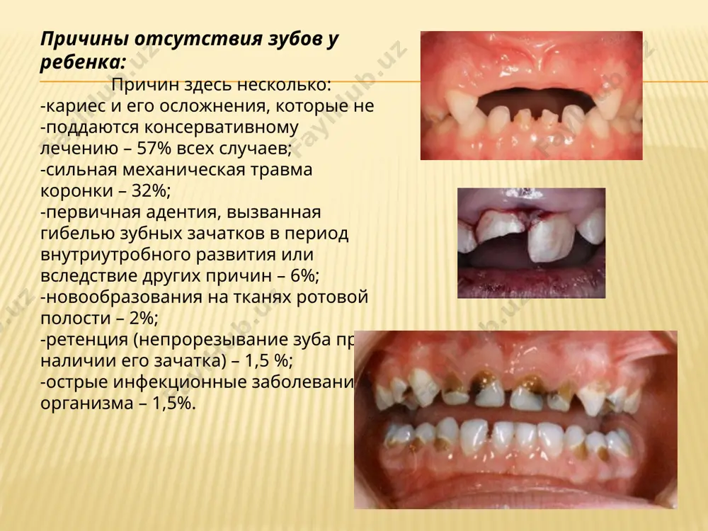 ego vo vlajnoy srede materiala. estetichnimi. dlya izgotovleniya protezov ispolzuyut: plastmassi iz akrilata. xromirovannuyu stal. splavi na osnove olova i serebra. nerjaveyushuyu stal ei – 95. spasibo za vnimanie!!! image10.jpg image5.jpg image3.jpg image2.jpg image4.jpg image12.png image6.jpg image8.jpg image7.jpg image9.jpg image11.jpg image1.png