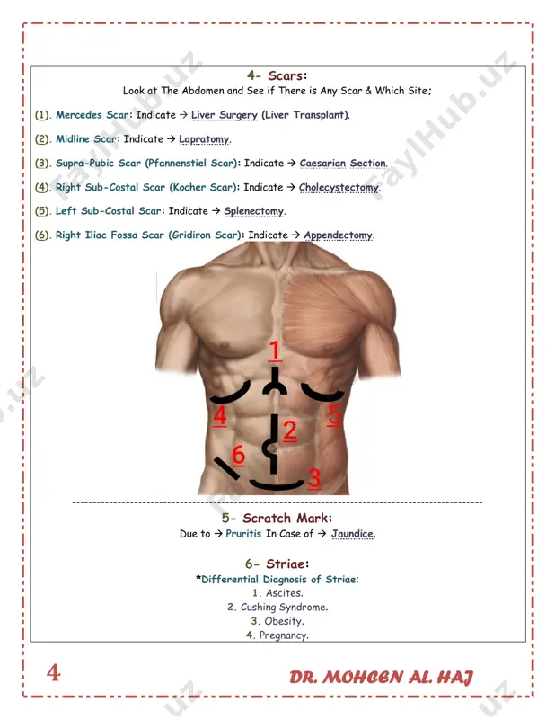 neys): 1. liver liver palpation: 1. right hand placed in right iliac fossa. 2. ask the patient to take slow deep breathing from his mouth. 3. palpate deeply in upward direction by radial border of index finger parallel to costal margin (or palpate by tip of the fingers), until reach costal cartilage along mid clavicular line. 4. when the patient do expiration;  pressure applied by your hand, and when the patient do inspiration;  you will feel the liver coming to your hand, (because during inspiration diaphragm descends and push the liver down). 5. normally liver not palpable (may liver palpable but only just 2cm below costal margin), but if it was palpable; you have to differentiate between hepatomegaly and pushed liver , (pushed liver means  liver pushed down due to hyper inflated chest as in copd). dr. mohcen al. haj 9 in case of huge ascites do …