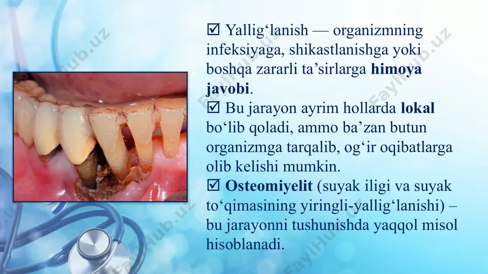 deformatsiyasi; surunkali fistulalar hosil bo‘lishi; uzoq davom etuvchi infeksion jarayon va immunitetning zaiflashuvi. shu boisdan, erta tashxis, to‘g‘ri antibiotikoterapiya, yiringni drenaj qilish, jarrohlik aralashuv va umumiy davolash choralari katta ahamiyatga ega. profilaktika maqsadida og‘iz gigiyenasiga rioya qilish, kariyes va periodontitni o‘z vaqtida davolash, travmalarni to‘g‘ri boshqarish hamda umumiy immunitetni mustahkamlash talab etiladi. 👉 umuman olganda, yallig‘lanish jarayonining organizmga tarqalishi — murakkab va xavfli patologik mexanizm bo‘lib, osteomiyelit uning eng muhim klinik ko‘rinishlaridan biridir. uni chuqur o‘rganish va nazorat qilish shifokorlar amaliyotida ham, bemor hayot sifatini saqlashda ham muhim o‘rin tutadi. e’tiboringiz uchun rahmat! image2.png image3.jpeg image4.png image5.jpeg image6.png image7.png image8.png image9.png image10.jpeg image11.png image12.jpeg image1.jpeg /docprops/thumbnail.jpeg