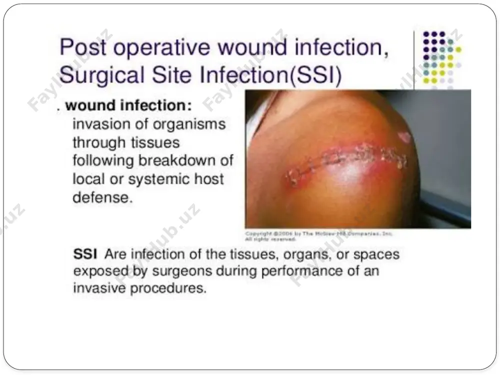 ive preparation care in operation theatre prophylactic antibiotics enhancement of host defences prophylactic antibiotics to prevent infection after surgery/ instrumentation when local wound defenses are not established-decisive period. maximal blood and tissue levels should be present at the time at which first incision is made and before contamination occurs single shot iv administration at induction of anesthesia repeat antibiotics at 4-hourly interval during surgery as tissue antibiotic levels often fall faster than serum levels during: longoperations excessive blood loss unexpected contamination occurs there is no evidence that further doses of antibiotics after surgery are of any value in prophylaxis against infection and can only result in antibiotic resistance. suggested prophylacic regimens for operations at risk type of surgery organisms prophylactic regimen vascular staph. aureus(mrsa) staph. epidermidis(mrcns) aerobic gram negative bacilli(agnb) 1dose augmentin +/- gentamicin, vancomycin/rifampicin orthopaedic staph. aureus/ epidermidis 1dose augmentin oesophagogastric enterobacteriaceae 1 dose-2nd generation cephalosporin+ metronidazole( sev. contamination) …