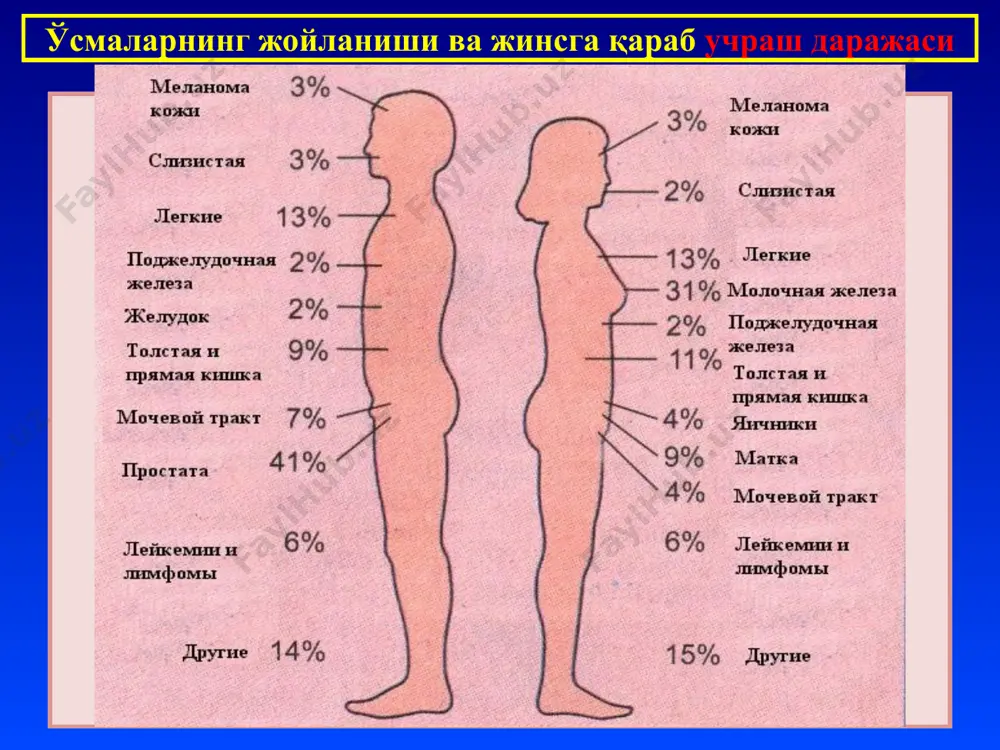 с, оғиз бўшлиғи, қизилўнгач, эндометрий, пешоб йўллари эпителийсидан ўсувчи хавфсиз ва хавфли ўсмалардир. папиллома – papilla – сўрғичли хавфсиз ўсма. тери, мугузланмайдиган ясси эпителийли шиллиқ пардалар: оғиз бўшлиғи, овоз бойламлари, буйрак жоми ва йўллари, сийдик пуфагидан ўсади. эпидермис қалинлашган, базал мембрана сақланган стромаси сўрғичлар пайдо қилиб ўсган полип – призматик эпителий қоплаган шиллиқ пардалар хавфсиз ўсмаси. сўрғич пайдо қилиб ўсган стромада жойлашган призматик эпителий меёр тузилишга эга, базал мембранаси бузилмаган. гистологик тузилиши бўйича бундай ўсмани аденоматоз полип дейилади. эпителий хавфсиз ўсмалари аденома – без аъзолар хавфсиз ўсмаси. без эпителийси меёр тузилишга эга, базал мембранада жойлашган. ўсмада без тузилмалари строма элементлари билан ҳар хил нисбатта. гистологик тузилиши бўйича: 1)фиброаденома; 2) ацинар; 3)альвеоляр; 4)тубуляр; 5) трабекуляр; 6)сўрғичли аденома. эпителий хавфсиз ўсмалари рак дифференциалланмаган ва етилмаган эпителий ҳужайраларидан ўсади. микроскопик формалари: “carcinoma in situ”; ясси эпителийли рак; аденокарцинома; шилимшиқли рак; трабекуляр рак; майда ҳужайрали рак; фиброзли рак (скирр); медулляр рак (мозговик). “carcinoma in …