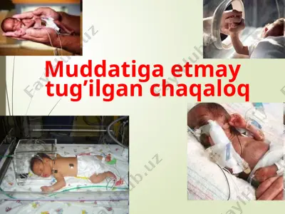 muddatiga etmay tug'ilgan chaqaloq — PPTX