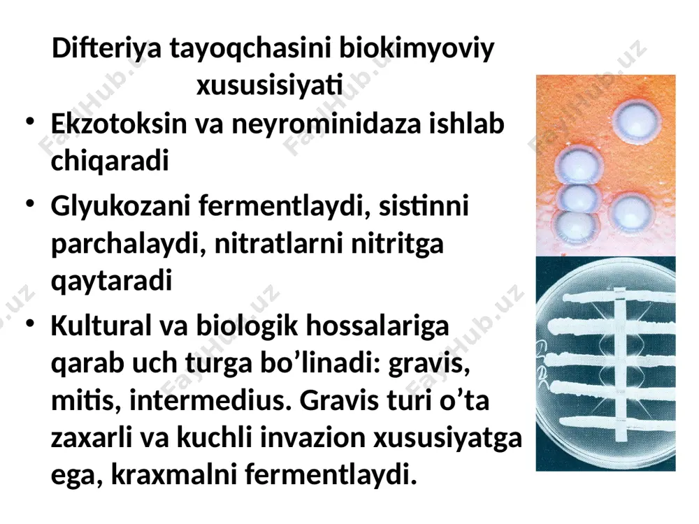 ko’pincha tomoq (xalqum) difteriyasida ikkilamchi ko’rinishda namoyon bo’ladi. ko’z difteriyasi ko’z difteriyasida parda ko’z shilliq qavatida bo’ladi, ayrim hollarda ko’z soqqasiga ham yoyilishi mumkin. jarohatlangan tomonda ko’z qovoqlari shishadi, zichlashadi, ko’zdan yiringli modda ajraladi, gohida yiringli modda qon aralash bo’lishi mumkin. yallig’lanish ko’pincha 1 ta ko’zda kuzatiladi. bemorning ahvoli qoniqarli bo’ladi. teri difteriyasi terining jarohatlangan sohasida rivojlanadi. terining yorilgan, tirnalgan, shishli, yarali, po’stloq-qatqoloqli, kuygan, sovuq urgan va h.k. sohalarida shish va difteriya pardasi hosil bo’ladi. jinsiy a’zolar difteriyasida qiz bolalarda tashqi jinsiy a’zolar shilliq qavatida yallig’lanish hamda difteriya pardasi kuzatiladi. ayrim hollarda kindigi kesilgan chaqaloqlarda kindik difteriyasi kuzatiladi. asoratlari miokardit infeksion-toksik shok nevritlar va polinevritlar nefrotik sindromi difteriyaning tipik asoratlari difteriyaning tipik asoratlariga periferik falajlar kiradi. erta falajlar: odatda bosh miya nervlari jarohatlanishi natijasida yumshoq tanglay falaji, manqalanib gapirish, yonayotgan shamni o’chira olmaslik, qalqib ketish hisobiga suyuq ovqatlarning burundan tushishi, yumshoq tanglay refleksi yo’qolishi, yumshoq tanglayning osilib turishi, tilchaning sog’lom …