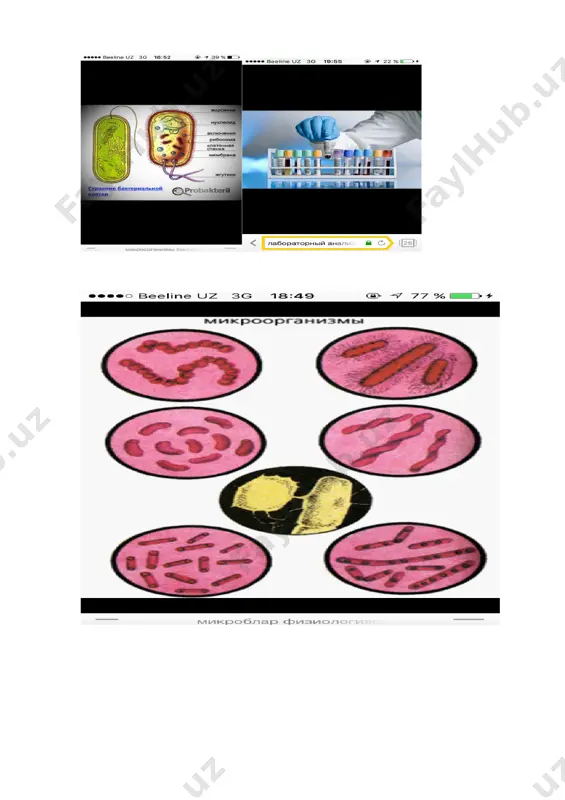 niqobtaqing; xalatkiying; niqobtaqing; maxsuspoyafzalnishippak) kiying. 2 infeksiya tushmasligiuchun aseptika va antiseptikaqoidalarigarioya qilgan holda qo’llaringizni sovunlab, tozalab yuving. suv, suyuqsovun. qo’llardagi taqinchoqlar va soatni yechib qo’ying. suv manbai jo’mragini ochib qo’lingizni suv oqimida suyuq sovun bilan yaxshilab, barcha qismlarini bir necha marta ishqalab yuving. 3 topshiriq:tekshirishuchun ish joyini jihozlash. qalin tomchiga qonolish. sterillangan lansetyokiigna paxta 70%li spirt noksimon plastik yoki boshqacha pipetka shisha kurakcha tirnalamagan toza buyum oynalari andaza (qon tomchisining kattaligini ifodalab, qog‘ozga chizilgan rasm) belgi qo’yish uchun qalam ish joyini to’g’ri jixozlanganligigae’tibor bering 4 bemorlardan yig’ilgan biomateriallarni qabul qilib olish, belgi qo’yish va tahlil varaqasini to’ldirish. analizlarni po’yhatga olish jurnali. mahsus tahtali sumkalar har bir bo’limniki alohida. mahsus qalam. buyum oynasiga belgi qo‘yib oling. buyum oynasini nazorat andazasi ustiga qo‘ying. 5 qalintomchigaqonolishniboshlang. paxta 70%li spirt barmoqni spirtga ho‘llangan paxta timpon bilan arting va qurigunicha kutib turing. 6 qonolishuchunignanisanching sterillangan lanset yoki igna 3-yoki 4-barmoq uchining yon tomoniga sterillangan lanset …