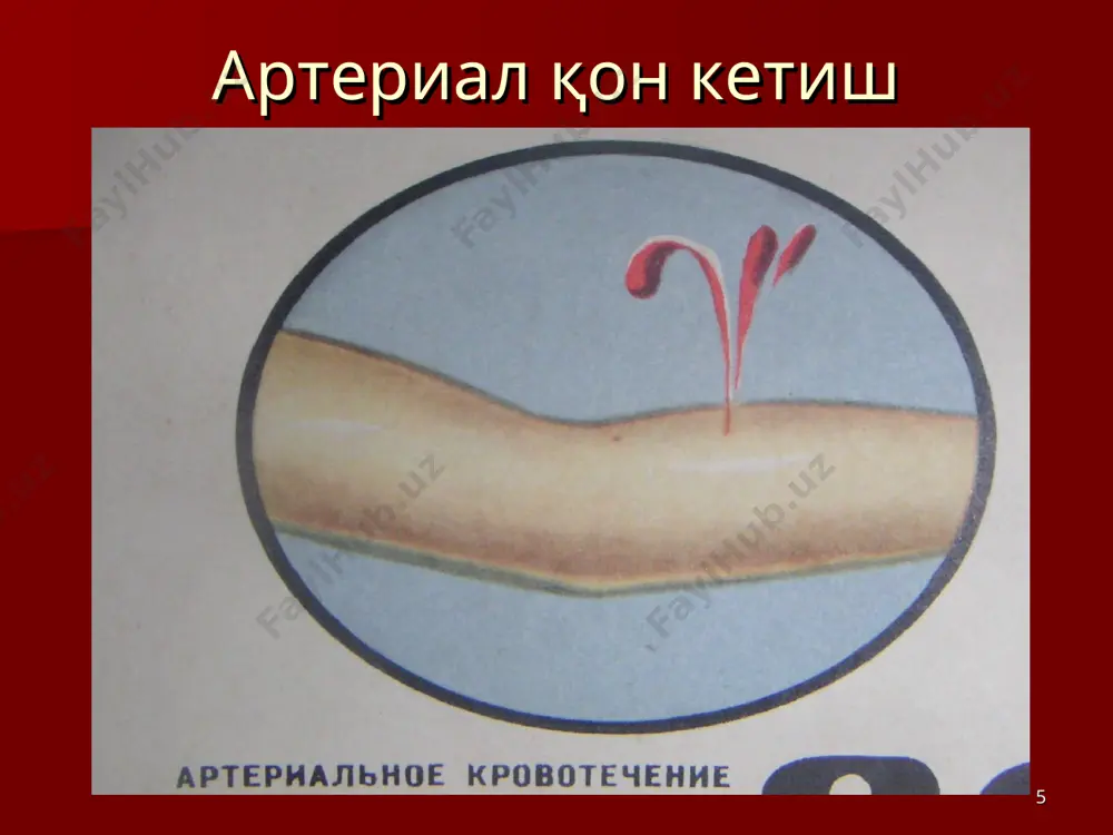 “қон кетиш ва уни тўхтатиш усуллари” маъруза - Page 5