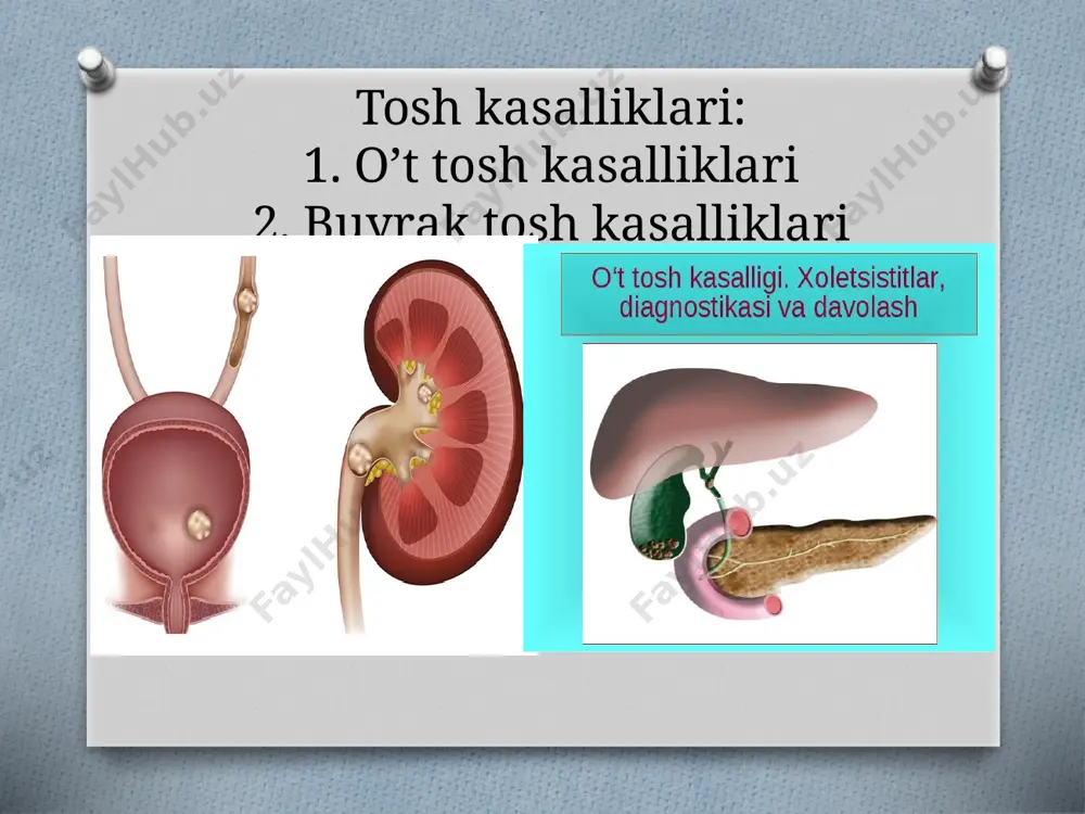 bog‘liq. buyrak-tosh kasalligi sabablari buyrak-tosh kasalligi sabablari to‘laligicha aniqlanmagan. biroq tanada moddalar almashinuvi buzilishi eng asosiy sabablardan. shuningdek, buyrak va siydik yo‘llaridagi infeksion yallig‘lanish tufayli yuzaga keladigan peshob ajratish (urodinamika) tizimining buzilishi ham kasallikni kuchaytirib yuboradi. buyrak-tosh kasalligi profilaktikasi kasallikning paydo bo‘lishi va rivojlanishining oldini olish uchun, avvalo, organizmdagi modda almashinuvini izga solish lozim. bunga sog‘lom turmush tarziga rioya etish va qat’iy parhez orqali erishiladi. kasallikni davolash bu kasallikni davolash asosan, organizmdagi moddalar almashinuvi buzilishini muvofiqlashtirish, buyrak va siydik yo‘llarida peshob harakatini ravonlashtirishdan iborat. shuningdek, siydik yo‘llaridagi infeksiyaga qarshi kurashiladi. e’tiboringiz uchun raxmat!!! image3.jpeg image4.png image5.png image6.png image7.png image8.png image9.png image10.png image11.png image12.jpeg /docprops/thumbnail.jpeg