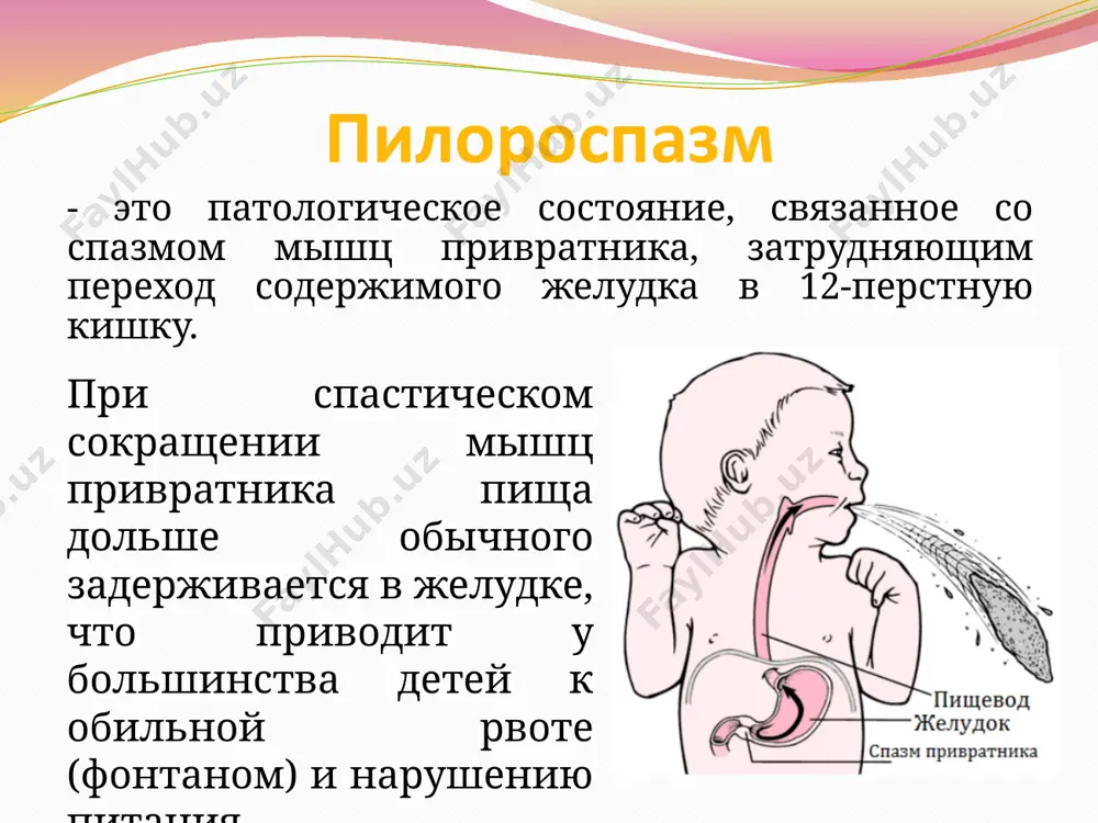 imeyut ryad otlichiy. otlichiya pilorospazma i pilorostenoza pilorospazm pilorostenoz funktsionalnoe rasstroystvo organicheskoe zabolevanie peristaltika ne vidna, jivot bezboleznenniy simptom «pesochnix chasov», boleznennoe uplotnenie v pravom podrebere toshnota, srigivaniya rvota obilnaya, fontanom kisliy zapax rvotnix mass gnilostniy zapax massa tela umenshaetsya neznachitelno silnaya poterya vesa poddayotsya konservativnoy terapii tolko xirurgicheskoe lechenie redkoe obezvojivanie chastoe obezvojivanie stul v norme zapori lechenie pilorospazma u kajdogo rebenka individualnie simptomi. i lechenie detey s diagnozom "pilorospazm" podbiraetsya individualno. na nachalnoy stadii rasstroystvo pitayutsya ustranit bez ispolzovaniya medikamentov. v dietu rekomenduetsya vklyuchit shelochnoe pite (mineralnuyu degazirovannuyu vodu — po 1-2 lojki posle kajdogo kormleniya). pisha luchshe perevarivaetsya pod vozdeystviem shelochnoy vodi. poetomu tak vajno poit rebenka posle kajdogo kormleniya. drobnoe kormlenie rebenka (grudnim molokom ili lechebnoy adaptirovannoy smesyu) — kajdie 1,5-2 chasa po 5-7 minut, malimi portsiyami. pisha doljna bit polujidkoy, teploy. posle kormleniya neobxodimo derjat rebenka v vertikalnom polojenii 30-60 minut, zatem klast na jivot. …