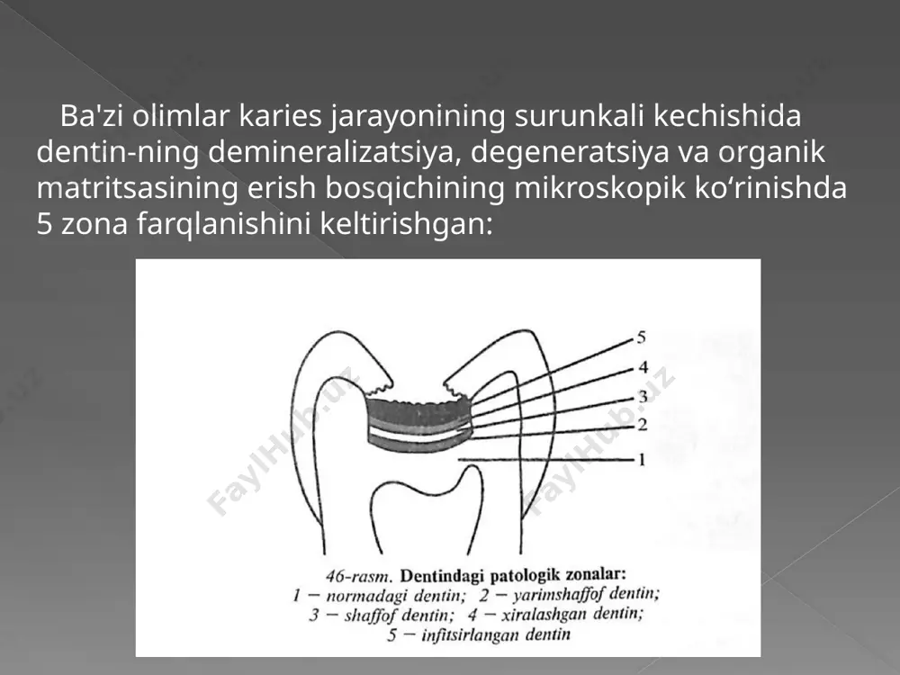 o’rta kariyes klinikasi - Page 5