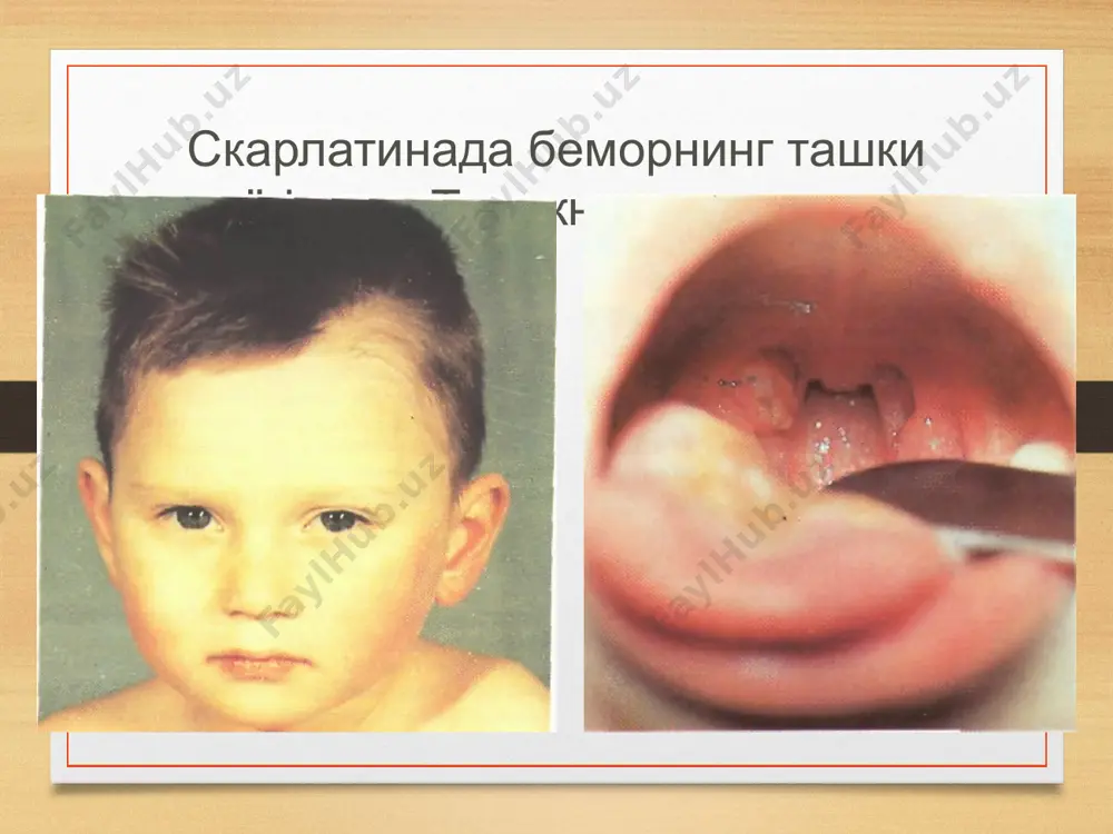 скарлатина - Page 5