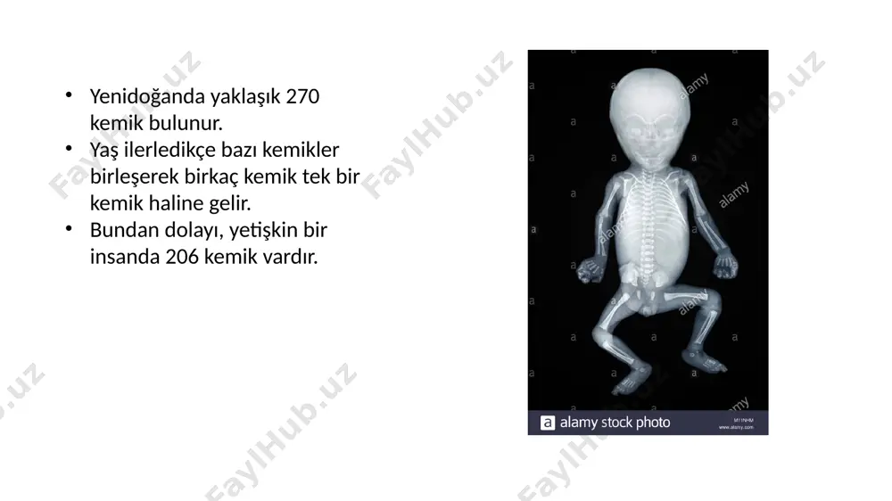 (ossa informia, ossa irregularia) principles of anatomy and physiology kemikleşme kemikler mezenşim kaynaklıdır. bir yerde kemik gelişeceği zaman, önce mezenşim doku oraya yerleşir, bu iki şekilde gerçekleşir: 1. intramembraneous (bağ doku kaynaklı) kafa tası gibi bazı kemikler, direk bağ dokusundan gelişir. 2. intracartilageneous (kıkırdak doku kaynaklı) önce kıkırdak doku haline döner, kıkırdak doku zemininde de kemik teşekkül eder. kemik matriksi (osteoid) meydana geldikten sonra, bunun üzerine madeni tuzlar oturur -endokondral (içten) kemikleşme -perikondral (dış yüzeyden) kemikleşme intramembranöz kemikleşme temel olarak yassı kemiklerde görülür mezenkimal dokudan gelişir kemikleşme sahasında bağ dokusu hücreleri, osteoblastlara dönüşür. osteoblastlar, osteoid maddesini daha sonra kollajen liflerini salgılayarak kemiğin matrixini yapar matrixte nokta şeklinde tuz oturması görülür. (kemikleşme merkezi) kemikleşme merkezleri birleşerek bütün kemik oluşur trabeküllerin şekillenir. periosteum gelişir. perikondral kemikleşme: uzun kemiklerde görülür. kemiklerin enine büyümesi, periostun iç tabakasında bulunan osteoblastların faaliyeti ileolur. kıkırdak doku etrafını saran perikondriumun iç yüzündeki bağ dokusu hücreleri osteoblastlara dönüşür taslağın …