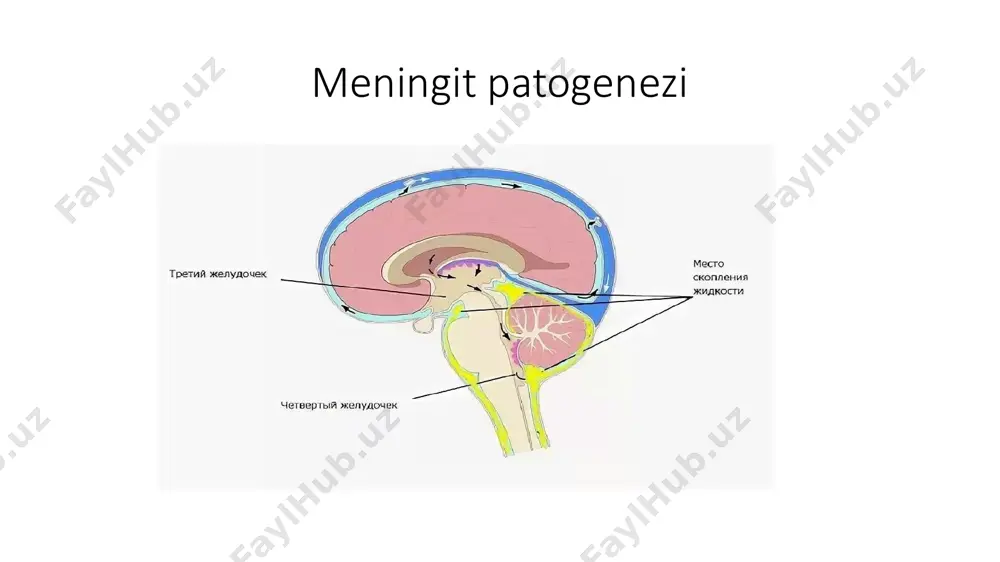 meningit - Page 3