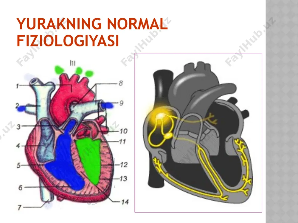 n aorta stenozining asosiy sababi revmatizm kasalligi hisoblanadi. kamroq hollarda aorta aterosklerozi, infyektsiyali endokardit va qopqoqchalardagi birlamchi degenerativ o‘zgarishlar sabab bo’ladi. mumkin aorta qopqoqchalari yetishmovchiligiga aksariyat hollarda revmatizm va kamroq infyektsiyali endokardit sabab bo‘ladi. ba’zan ateroskleroz, zaxm, tizimli qizil volchanka ham ushbu nuqsonga olib kelishi mumkin. klinik manzarasi aorta ravog‘i stenozi bilan og‘rigan bemorlar uzoq vaqt davomida shikoyat bildirmaydilar va bu nuqsonni kompensatsiya bosqichida ekanligidan dalolat beradi. ilk shikoyatlar aorta ravog‘i kengligi taxminan 50 % torayganda paydo bo‘ladi kasallikning ilk klinik belgilaridan biri bo‘yin sohasi va boshda pulsatsiya hissi hamda yurak urishining kuchayishi hisoblanadi. stenokardiya xurujlari ham yaqqol namoyon bo‘ladi. shikoyatlar kasallik boshlanishida (kompyensatsiya bosqichida) bemor shikoyatlari yurak zarbi va nisbiy koronar yetishmovchilik belgilarini aks ettiradi. aorta stenozi bilan og‘rigan bemorlar uchun jismoniy harakat vaqtida yoki tana holati tez o‘zgarganda paydo bo‘luvchi bosh aylanishi, ko‘ngil aynishi, hushdan ketish (sinkopye) kabi shikoyatlar xos. hansirash yaqqol namoyon bo‘lgan aorta yetishmovchiligida bosh aylanishi, …