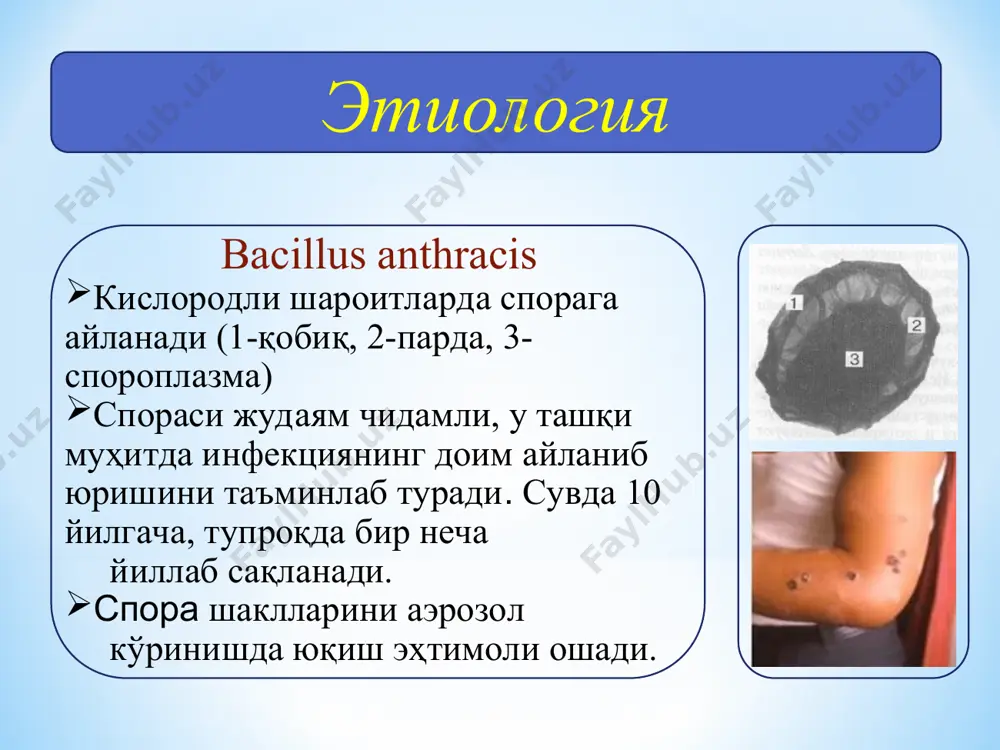 и ўзгаришлар куйдиргининг (абдоминал) шакли: ўзига хос белгилари: интоксикация белгилари кўпинча қориндаги оғриққа нисбатан кучли намоён бўлади; оғир кечуви (шок, двс); асцит риожланиши; куйдиргининг (абдоминал) шакли (шубҳали ҳолатлар): касалликнинг ўткир бошланиб, оғир кечиши ва қуйидаги белгилардан 2 тасини мавжудлиги: юқори иситма; инфекцион-токсик шок; двс; куйдиргининг (абдоминал) шакли (шубҳали ҳолатлар): маҳаллий ўзгаришларнинг қуйидагилардан камида 2 тасини мажудлиги: қоринда кучли оғриқ; қон билан ич кетиши; қон билан қусиш; асцит. куйдиргининг орофарингеал шакли: инкубацион давр 1-6 кун (ўртача 2-5 кун) 1- ҳафта иситма томоқда кучли оғриқ кучли фарингит бўйинни бир томонлама шиши оғиз-халқум орқа деворининг зарарланиши (кўпинча бодомсимон безларни) 2 - ҳафта яра ва некротик ўчоқлар; яра устини жигарранг ёки кул ранг парда билан қопланиши; нафас йўлини шиш билан қопланиб, ёпилиб қолиши куйдиргининг оғиз-халқум шакли ўзига хос белгилари: оғиз-халқум шиллиқ қаватида бирламчи аффект ривожланиши: ярали некротик кўринишда; бўйин клетчаткасининг бир томонлама шиши. куйдиргининг оғиз-халқум шакли (шубҳали ҳолатлар): касалликнинг ўткир бошланиб, оғир кечиши ва …