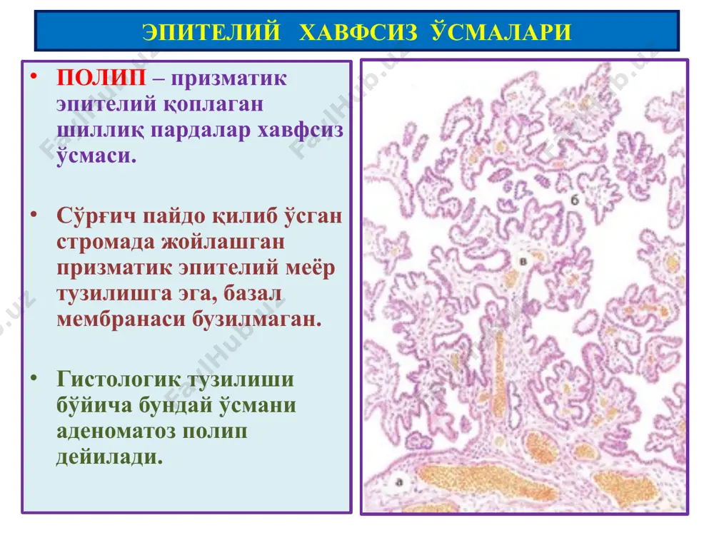 ўсмалар. мезенхимал ўсмалар - Page 4