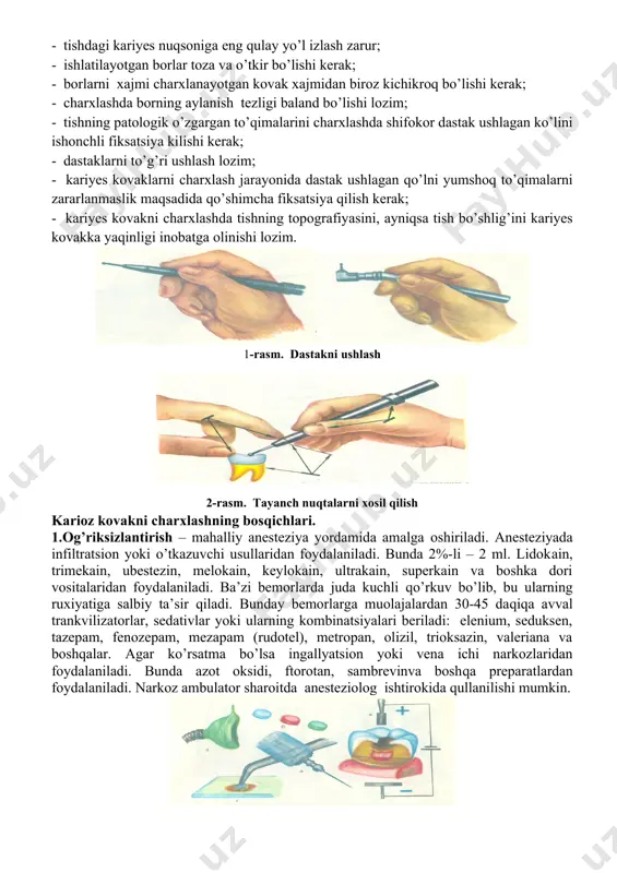 dan formulirovka kilingan bo’lib, uning asosida qayta tiklanuvchi materialning ishonchli fiksatsiyasini ta’minlovchi va ikkilamchi kariozli jarayonning oldini oluvchi ikki asosiy holat «retentsiya» va «rezistentsiya» yotadi. kariyes kovaklarni charxlashning umumiy qoidalari. kariyes kovaklarni charhlashning asosiy maqsadi: - patologik o’zgargan emal va dentinni charhlash; - plomba ashyosini turishiga optimal sharoit yaratish va shu bilan birga tishni anotomik va funktsional birligini tiklash. tishlarni kariyes kasalligini maxalliy davolash maqsadi – patologik o’zgargan to’qimalarni olishdan so’ng, tishni anatomik va funktsional vazifasini tiklashdan iboratdir. kariyesni davolash asosan chirigan to’qimalarni turli borlar yordamida charxlab, doimiy plomba uchun optimal sharoit yaratish hisoblanadi. charxlash usulini bajarishda bir necha qoidalar mavjud: - charxlash maydoni yaxshi yoritilgan bo’lishi lozim; - tishdagi kariyes nuqsoniga eng qulay yo’l izlash zarur; - ishlatilayotgan borlar toza va o’tkir bo’lishi kerak; - borlarni xajmi charxlanayotgan kovak xajmidan biroz kichikroq bo’lishi kerak; - charxlashda borning aylanish tezligi baland bo’lishi lozim; - tishning patologik o’zgargan to’qimalarini charxlashda shifokor …