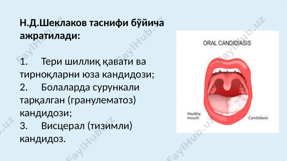мумкин. сурункали атрофик кандидозда оғиз бўшлиғини қуриши, ачишиши, протез таққанда оғриқлар бўлиши, протез майдонидаги шиллиқ қават гиперемияланган, шишган, огриқли кўриниши билан характерланади. солиштирма ташхис. сурункали кандидозни: қизил ясси темиратки лейкоплакия медикаментоз стоматитни хар хил формалари сифилитик папула акрил пластмассалари таъсиридаги аллергик стоматит билан ўтқазилади. сурункали атрофик кандидоз (candidosis chronica atrophica). кўпинча оѓизда тиш протези жойлашадиган шиллиќ ќаватини жароћати, пластмассага бўлган аллергия ва тиш протезларини узоќ таќиш натижасида сурункали атрофик кандидоз келиб чиќади. замбуруѓли стоматитга учта симптом хос: - ќаттиќ танглайни гиперемияси, эрозияси, папилломатози; - тилни гиперемияси, сўрѓичлар атрофияси,папилломатози; - лаб бурчакларининг бичилиши. айрим холларда сурункали кандидоз алоћида жойларда учрайди: лабларда (кандидозли хейлит), оѓиз бурчакларида (бичилишлар), тилда (кандидозли глоссит) микотик бичилиш кўпроќ кексаларда прикуси пасайган холларда ёки нотўѓри протезлаши, тишни ќаттиќ тўќималарини хаддан зиёд емирилиши ва адентияда кузатилади. микотик бичилиш. оғиз бурчагида чуқур бурмалар бўлган, еши катталарда учрайди, бу эса нотўғри протезлаш натижасида прикуснинг пасайиши,тишларни емирилиши ва адентияни асорати хисобланади. касаллик …