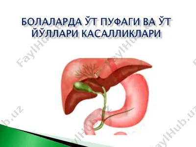 холецистит — PPT