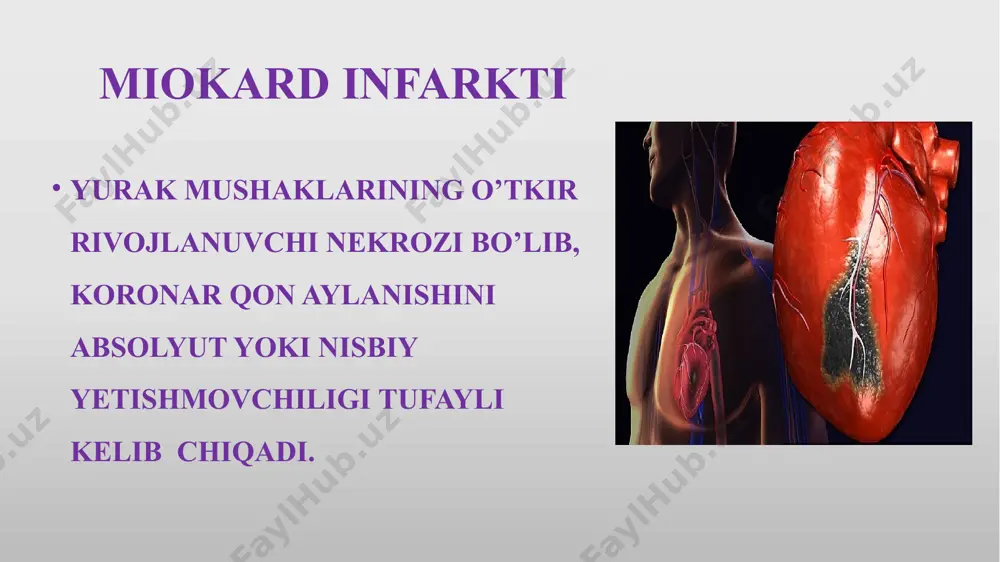 o'yicha : transmural (q tishli) transmural bo'lmagan (q tishsiz): subendokardial va intramural ii. kechishiga ko’ra: birlamchi (anamnezida mi avval bo’lmagan) retcidivlanuvchi (mi 3 kundan -28 kungacha qaytalansa) takrorlangan (mi -28 kundan keyin qaytalansa ) iii. mi ni lokalizatsiyasi bo‘yicha : 1.chap qorincha (old, yon, orqa, pastki devor) miokard infarkti. 2. yurak cho’qqisi (apikal) miokard infarkti. 3. yurak to’sig’i (septal) miokard infarkti. 4. qo’shilib kelgan lokalizatsiyali miokard infarkti: orqa yon (posterolateral); anterobazal (yuqori old); anterolateral; oldingi septal; oldingi apikal; orqa diafragmal; tarqalgan orqa; bazal; keng tarqalgan old (septal, apikal va lateral) va b. 5. o'ng qorinchaning mi. iv. miocard infarti davrlari : 1. prodromal davr - 30 dakiqadan 30 kungacha davom etadi (nosstabil stenocardia) 2. o’ta o’tkir davri - stenocardia huruzhi boshlanishidan necroz belgilari paydo bo’lguncha bo’lgan davr. davomiyligi bir necha soat (2-6 soatdan 1-2 kungach) 3. o’tkir davri - necrotic massalarning so’rilishi, chandiq hosil bo’lishining boshlanishi bilan xarakterlanadi - 10 …
