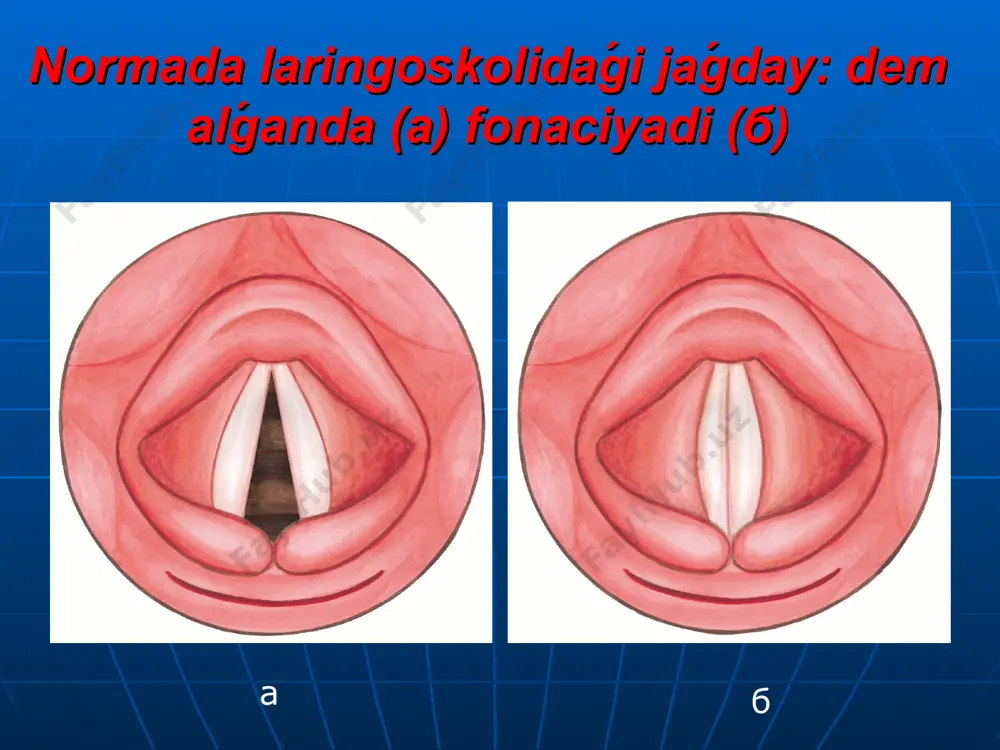 yetke iye. inverted papilloma qawipsiz óspe esaplanadı, biraq 10 -15% jaǵdaylarda ol jalpaq kletkalı karsinomaga aylanadı. murın hám murin atirapi raki : - kóbinese (55%) joqarǵi jaq ziyanllanadi; - murın boslig'i - 35%; - etmoid sinuslar - 9%; - júdá kemnen-kem jaǵdaylarda sfenoid sinus hám murın septumiga ziyanllanadi. murın hám murin atirapi qawipli óspe ge alip keliwshi faktorları : er adamlarda qawipli óspeler hayallarǵa qaraǵanda 2 ese kóp ushraydı. uzaq múddetli sinusit, ásirese bir tárepleme, qawipli óspege aylanıwı múmkin. nikel sanaatında isleytuǵın jumısshılar jalpaq kletkalı karsinomaga ótiw múmkinshiligı 100 ese kóbirek; basqa kásiplik qáwip faktorları : aǵash shańları, hár qıylı sherim ónimleri, xrom boyawları, gorchica gazları hám basqalar.
