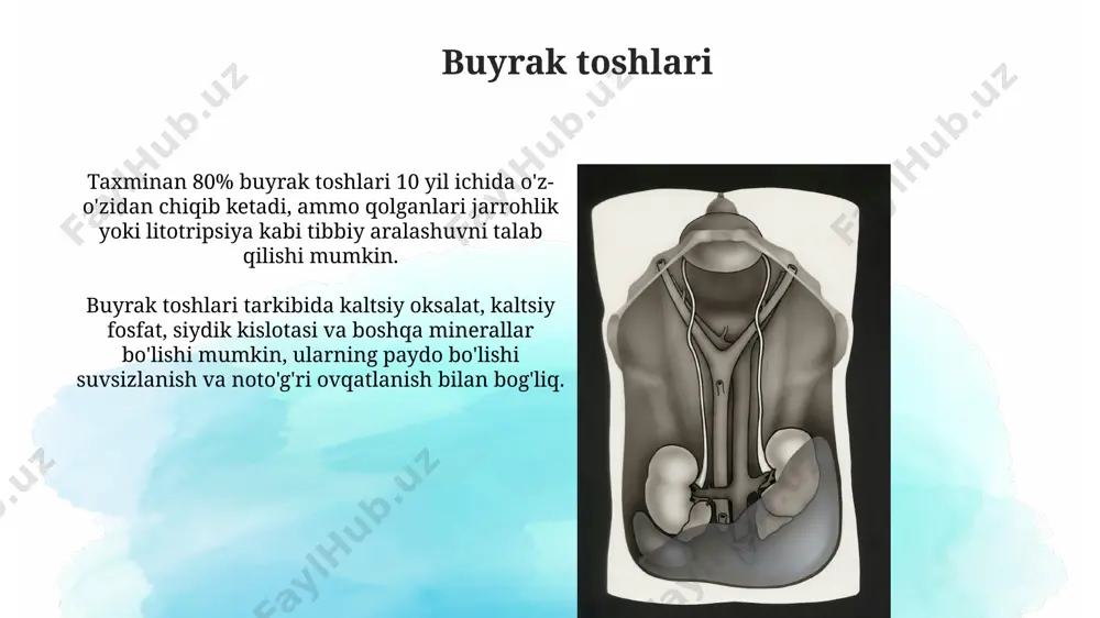 hollarda o'tkir buyrak yetishmovchiligiga olib kelishi mumkin, bu esa qonning filtrlanish tezligining keskin pasayishi bilan tavsiflanadi. glomerulonefrit гломеруляр фильтрация тезлиги (gfr) гломерулонефритда 60 мл/мин/1,73 м² дан пастга тушиши, бу буйрак етишмовчилигининг даражасини кўрсатади. гломерулонефритнинг кўплаб турлари мавжуд бўлиб, уларнинг 85% инфекциялар билан боғлиқ, қолганлари эса аутоиммун касалликлар ёки генетик омиллар билан боғлиқ. buyrak kasalliklarining umumiy belgilari gipertenziya buyrak kasalliklarida keng tarqalgan bo'lib, bemorlarning taxminan 80% da uchraydi va buyrak shikastlanishining erak dastlabki belgisidir. buyrak yetishmovchiligi 1,5-2 mg/dl dan yuqori kreatinin darajasi va gfr (glomerulyar filtratsiya tezligi) ning pasayishi bilan namoyon bo'ladi. e'tiboringiz uchun rahmat @taqdimot_robot image2.jpg image3.jpg image4.jpg image5.jpg image6.jpg image7.jpg image8.jpg image9.jpg image10.jpg image11.jpg image12.jpg image13.jpg image1.png