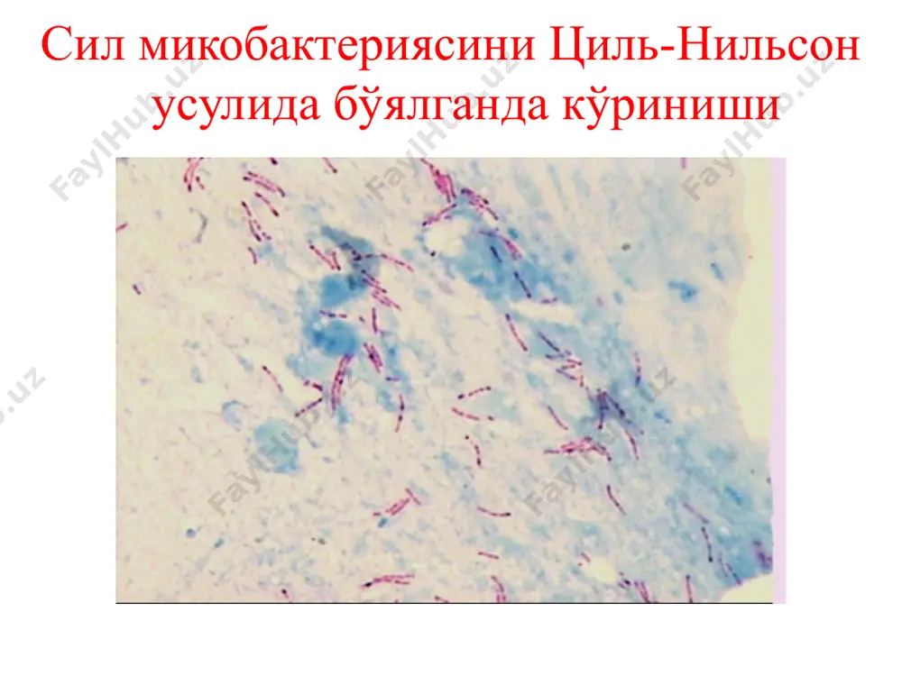 нхлар силининг клиник белгилари мавжуд бўлганда; -трахеобронхиал дарахтдаги носпецифик яллиғланишнинг клиник белгилари бўлганда; -сил микобактериялари ажралишининг ноаниқ ўчоғини топишда; -қон туфлаш ва қон кетишда; -«шишган» ёки «ёпилган» каваклар, айниқса «суюқлик сатҳи» ни аниқлашда; -жарроҳлик муолажаси ёки сунъий пневмоторакс қўйишдан олдин; -операциядан кейин бронх чўлтоғининг ҳолатини аниқлаш ва ревизия қилиш; -ноаниқ касалликларда; -трахеобронхиал дарахтни динамикада кузатишда (илгари трахея ва бронхда сил, носпецифик эндобронхит аниқланган беморлар); -операциядан кейинги ателектазларда; -трахея ва бронхлардаги ёт жисмларни топишда. бронхоскопияга монеликлар мутлақ монеликлар: -юрак-томир тизими касалликлари: аорта аневризмаси, юрак нуқсони декомпенсация босқичида, ўткир миокард инфаркти; -нафас етишмовчилигининг 3 босқичи; -уремия, шок, бош мия ёки ўпка томирлари тромбози. бронхоскопия — единственный на сегодняшний день метод, позво- ляющий: визуально исследовать состояние внутренней поверхности трахеи, бронхов вплоть до субсегментарных и более мелких; • непосредственно увидеть патологические образования, их распро- страненность; •получить содержимое для цитологического, гистологического, бактериологического, иммунологического и биохимического исследований; • определить косвенные признаки поражения лимфатических узлов средостения. image1.jpeg …