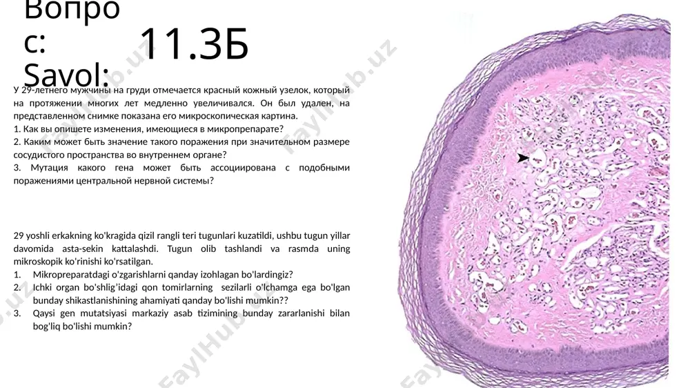 bemorning sababiy uzviyatli shakli (arterit) - Page 5