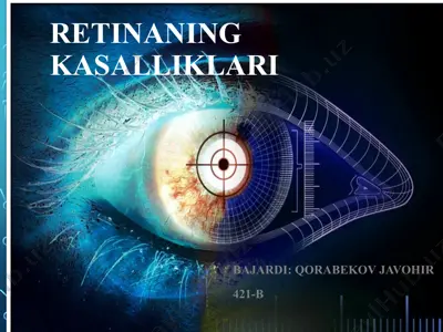 retinaning kasalliklari — PPT