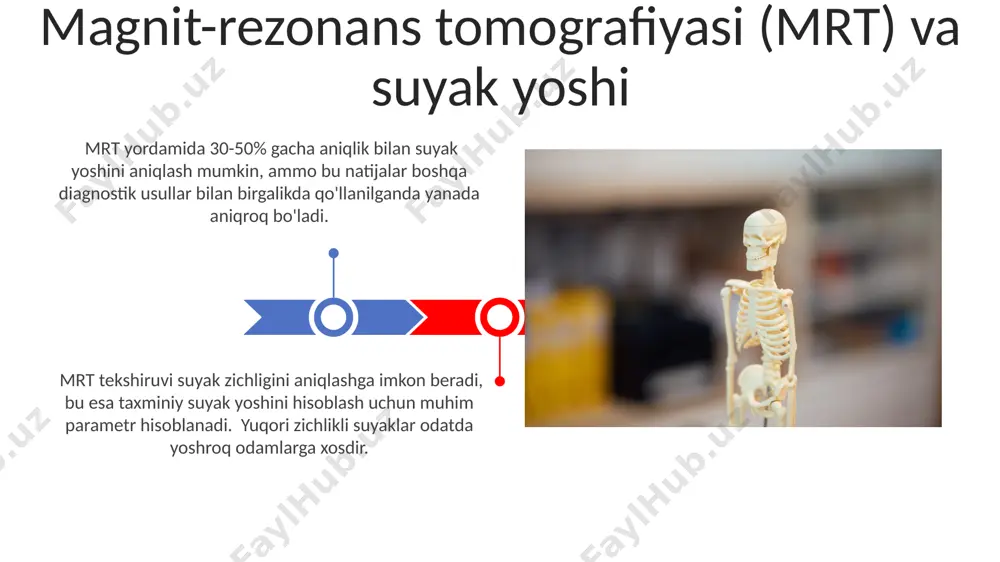 uzilishi va yosh belgilari havoliy to'qima miqdorining ortishi (masalan, 60 yoshdan keyin) va trabekulyar suyak tuzilishining yo'qolishi suyakning mo'rtlashuviga va sinish xavfini oshiradi. suyak to'qimasida gipermineralizatsiya darajasi yosh bilan ortadi, masalan, 50 yoshdan keyin mineral zichligi sezilarli darajada pasayadi va bu rentgenografiyada aniqlanadi. rentgenografiya orqali suyak yoshini aniqlash rentgenografiya orqali qo'l va oyoq suyaklarining epifizlari va diafizlari o'rtasidagi birikish chiziqlarining yopilish darajasini aniqlash orqali 18 yoshgacha bo'lgan bolalarda suyak yoshini aniqlash mumkin. rentgenogrammalarda suyaklarning tuzilishi, masalan, trabekulyar tuzilishning o'zgarishi va kortikal qatlamning qalinlashuvi yoki yupqalashuvi kabi omillarni tahlil qilish orqali taxminiy suyak yoshini aniqlash mumkin, bu esa 30 yoshdan keyin ancha aniqroq bo'ladi. suyak zichligi va yoshning o'zaro munosabati suyak zichligi odatda 30 yoshdan keyin asta-sekin kamayib boradi, ayniqsa ayollarda menopauza davrida tezlashadi, bu osteoporoz xavfini oshiradi. 50 yoshdan oshgan ayollar va 70 yoshdan oshgan erkaklarda suyak sinishi xavfi yuqori bo'lib, suyak zichligini muntazam tekshirish va profilaktika choralarini ko'rish zarur. …