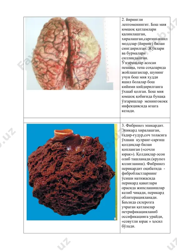 яллиғланиш ва репарация - Page 4