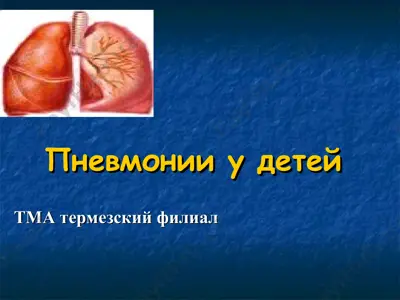 пневмония у детей — PPT