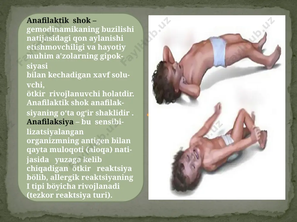 anafilaktik shok - Page 2