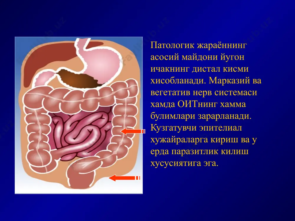 нчи кунларида, ичакда кучли структур –функционал узгаришлар даврида ахлатда хам секретор, хам зардоб jga топилади, бу ичак бушлигида зардоб оксилларининг транссудацияси кучайиши натижасида юзага келади. антителолар ишлаб чикарилади, иммуноглобулинлар активланади. реконвалесценция даври бошланади. паталогик анатомияси а. катарал- фолликуляр колит б. фибриноз-ярали колит а. соглом йугон ичак шиллик кавати. б. катарал-фолликуляр колит. в. эррозив-ярали колит. г. атрофик колит. а. б. в. г. дизентериянинг клиник таснифи уткир дизентерия 1. колитик шакли: - енгил; - урта огир; - огир; - ута огир; - яширин дизентериянинг клиник таснифи 2. гастроэнтероколитик шакли: - енгил; - урта огир; - огир; - ута огир; - яширин. дизентериянинг клиник таснифи ii. бактерия ташувчилик ш.сурункали дизентерия 1. кайталовчи 2. узлуксиз уткир дизентерия енгил колитик шакли- уткир бошланади, t= 37 – 38с, холсизлик, иштаха пасайиши кузатилади. коринда кучсиз огрик, ич келиши 3-5 марта, лекин 10 мартадан куп эмас. уткир дизентериянинг енгил шакли клиник кечиш характеристикаси уткир дизентерия урта огир шакли …