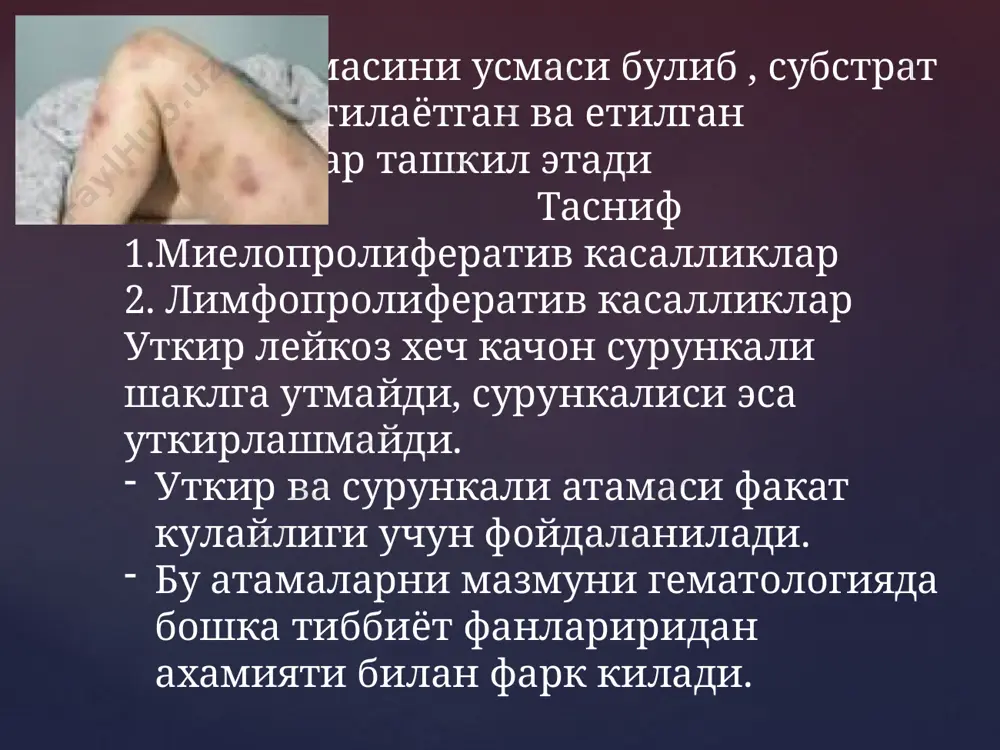 ва бласт кризи. сурункали фазаси мезонлари : -гепатоспленомегалия; -периферик конда лейкоцитлар > 80*10.9/л. -лейкоформулада; миелобласт ва промиелоцитлар 4 % дан купрок. -кизил кумикда умумумий хужайралар > 350*10.9/л. -бластлар ва промиелоцитлар кизил кумикда > 8 % -кизил кумикда нейтрофиллар, ,бласт шакллари билан > 85 %. чин эритремия ( полицитемия, вакез касаллиги) -сурункали лейкоз – барча миелопоэз, биринчи навбатда эритроцитларни пролиферацияси билан характерланади. -усма усиши учоги миелопоэзни утмишдаги хужайраси хисобланади, бу эритроцитлар, гемоглобин микдори ошиши, циркуляция этувчи кон массаси ва ёпишкоклигини ошишига олиб келади. (баъзи холларда лейкоцитлар ва тромбоцитлар микдори ортади ). эпидемиологияси- узбек популяциясида камдан кам учрайди . асосан яхудий, литва, латиш,эстон миллати вакилларида купрок учрайди. этиопатогенези сурункали миелолейкоз каби клиникаси -тери рангини узгариши- кизил-кукимтир кизариш куплиги билан -склера томирлари кизариши- товушкон кузи каби - юзи, буйни ва баданни юкори кисми, кафтлар кизил-гилос рангида -тери кичиши ( ванна кабул килгандан кейин кучаяди) эритромелалгия- бармоклар учида, товон ва болдир сохасида куйдирувчи огриклар. …