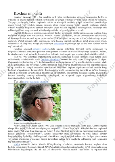 koxlear implanti — DOCX