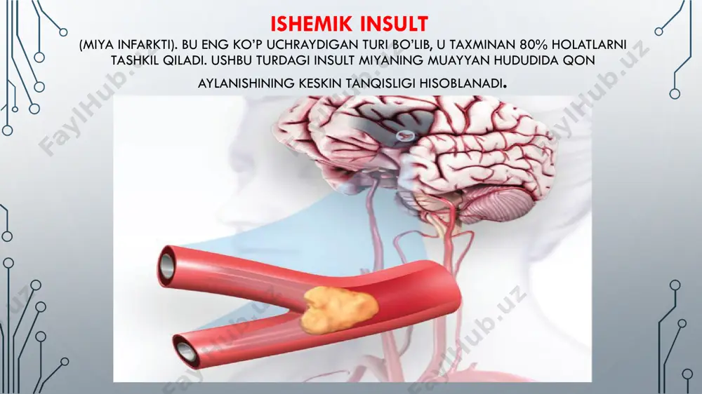i va alomatlari • patologiyaning belgilari quyidagicha namoyon bo’ladi: • - to’satdan zaiflik, uyqusizlik, yuz mushaklarining falajlari (odatda tananing bir tomonida); • - nutqni yo’qotish; • - bir yoki har ikkala ko’zning ko’ra olish qobiliyati buzilishi; • - bosh aylanishi va o’tkir bosh og’rig’i; • - muvozanat yo’qolishi va yurishning keskin buzilishi. • ushbu alomatlar yuzaga kelganda tezda tez yordam chaqirish kerak! insultning eng ko’p uchraydigan alomatlari ikkita shartli guruhga bo’linadi: • umumiy miya simptomlari. bu miya yarimsharlari jarohatlanishi bilan bog’liq alomatlar. ushbu alomatlarga bosh aylanishi, karaxtlik kabilar kiradi. • o’chog’ belgilari. bularga to’satdan parez, falajlik, shuningdek, ko’rishning buzilishi, ko’z qorachig’i joyining o’zgarishi, ishonchsiz nutq, harakatni muvofiqlashtirmaslik, qo’zg’atuvchi bo’yin muskullari va boshqalar kiradi. • kasallik belgilarini to’g’ri qabul qila olish juda muhimdir, chunki davolash faqatgina agar qon tomir jarohatidan keyin 3-6 soat o’tib boshlansagina ijobiy yakun topadi. gemorragik insultning dastlabki belgilari miyada qon ketishi, ishemik insultniki esa miyada nekrotik hudud …