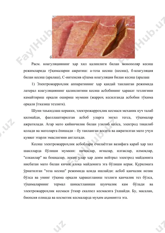 такт коагуляциясини тезлаштиришга ҳаракат қилганда, электродга улашган тўқималар тезда қурийди, уларнинг карбонатланиш жараёни бошланади. олинган қорақўтир тўқималарнинг чуқур қатламларини электр токидан ажратиб туради ва тўқималарга чуқур кирмайди. коагулянтнинг қалинлиги қон кетишини ишончли тўхтатиш учун этарли эмас ва у қайта тикланиши мумкин. бундай ҳолда, мато электродга ёпишиши мумкин, бу эса асбоб тўқималардан узоқлашганда коагулянтнинг ажралишига олиб келади. танланган восита ва режим учун ишлаб чиқарувчи томонидан тавсия этилган оптимал коагуляцион қувватни ўрнатиш керак ва асбобнинг матога таъсир қилиш вақтини камайтиришга интилмаслик керак. монополяр контакциз коагуляция контакциз монополяр коагуляция капилляр қон кетишида тез гемостазга ва юзаки патологик жараёнларда тўқималарнинг абласёнига эришиш учун ишлатилади. унинг контактли монополяр коагуляциядан асосий афзалликлари тўқималарнинг фаол электродга ёпишмаслиги ва тўқималарнинг микробиал ифлосланишини истисно қилишдир. шу билан бирга, контакциз монополяр коагуляция учун самарали таъсир фақат сирт (2-3 мм) тўқима қатламига эришилади. юқори частотали оқимнинг оқим даври юқорида тавсифланган монополяр кесиш режимларига ўхшайди. контакциз монополяр коагуляция режимларида юқори частотали оқим …